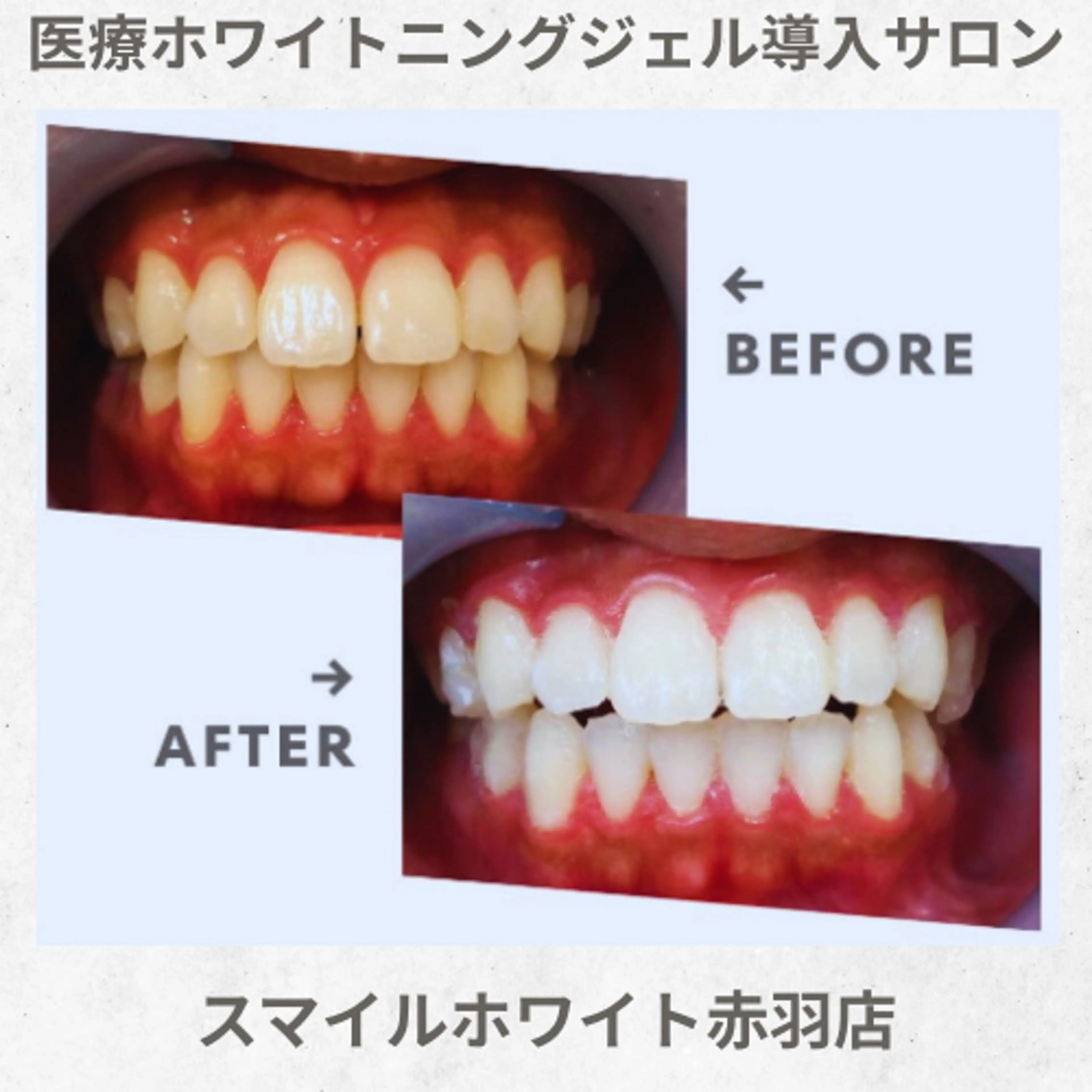 パーマ スマイルホワイト 赤羽店のエステ・リラクイメージ