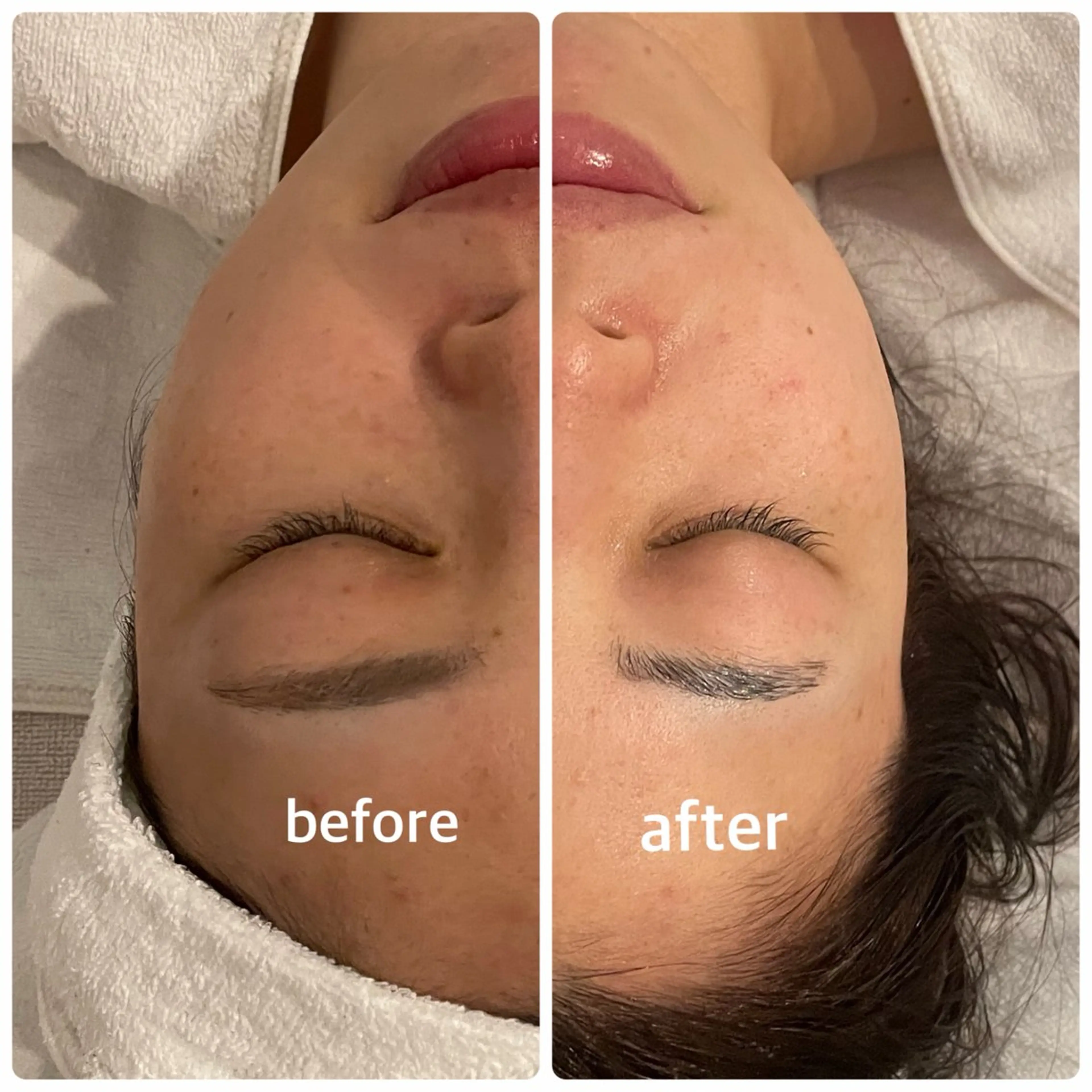 ピーリングmenu︴フェイシャル - くすみ・乾燥・ゴワつきケア🫧の写真