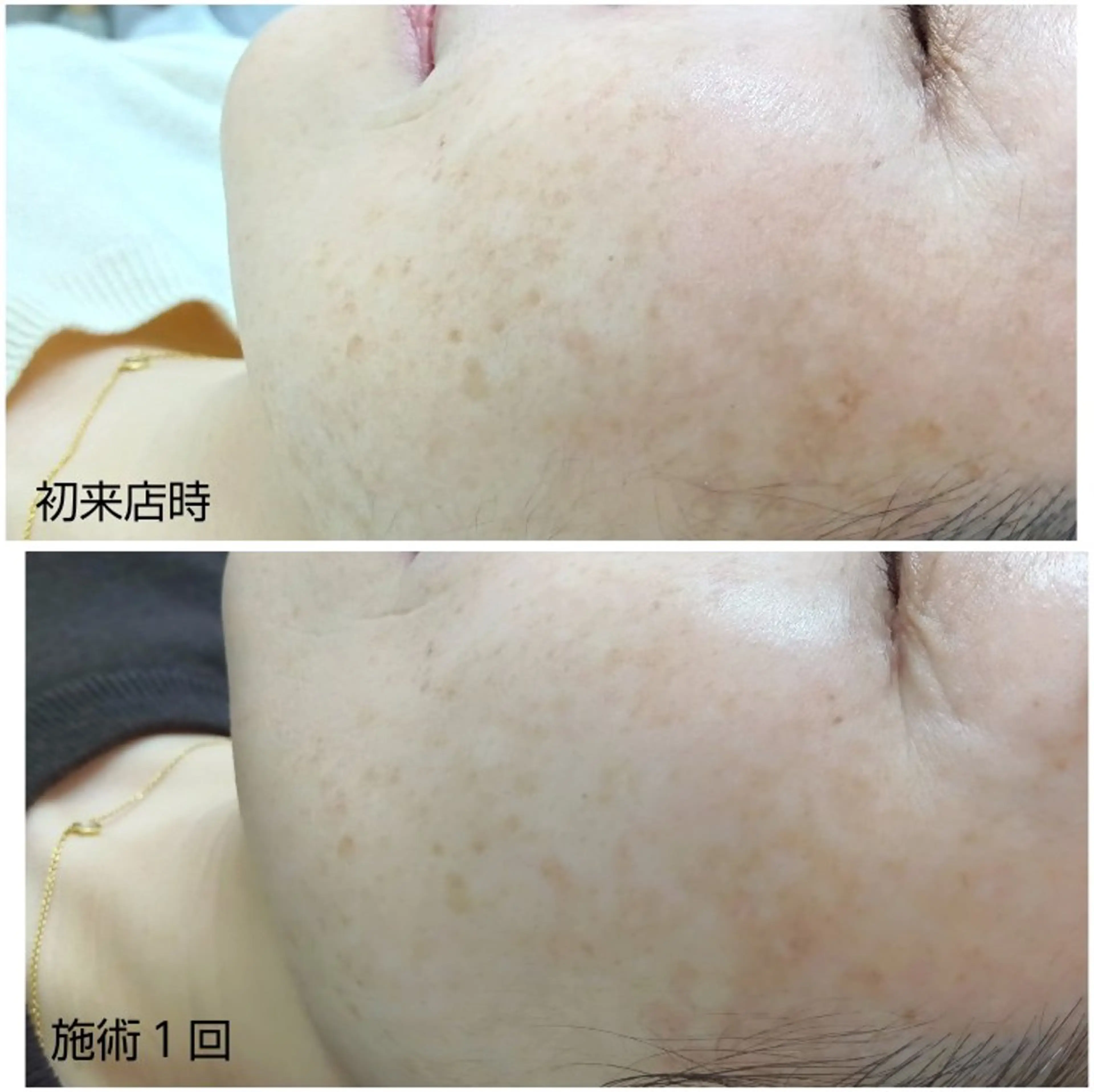 シミケア専門店 HAQUAのエステ・リラクイメージ