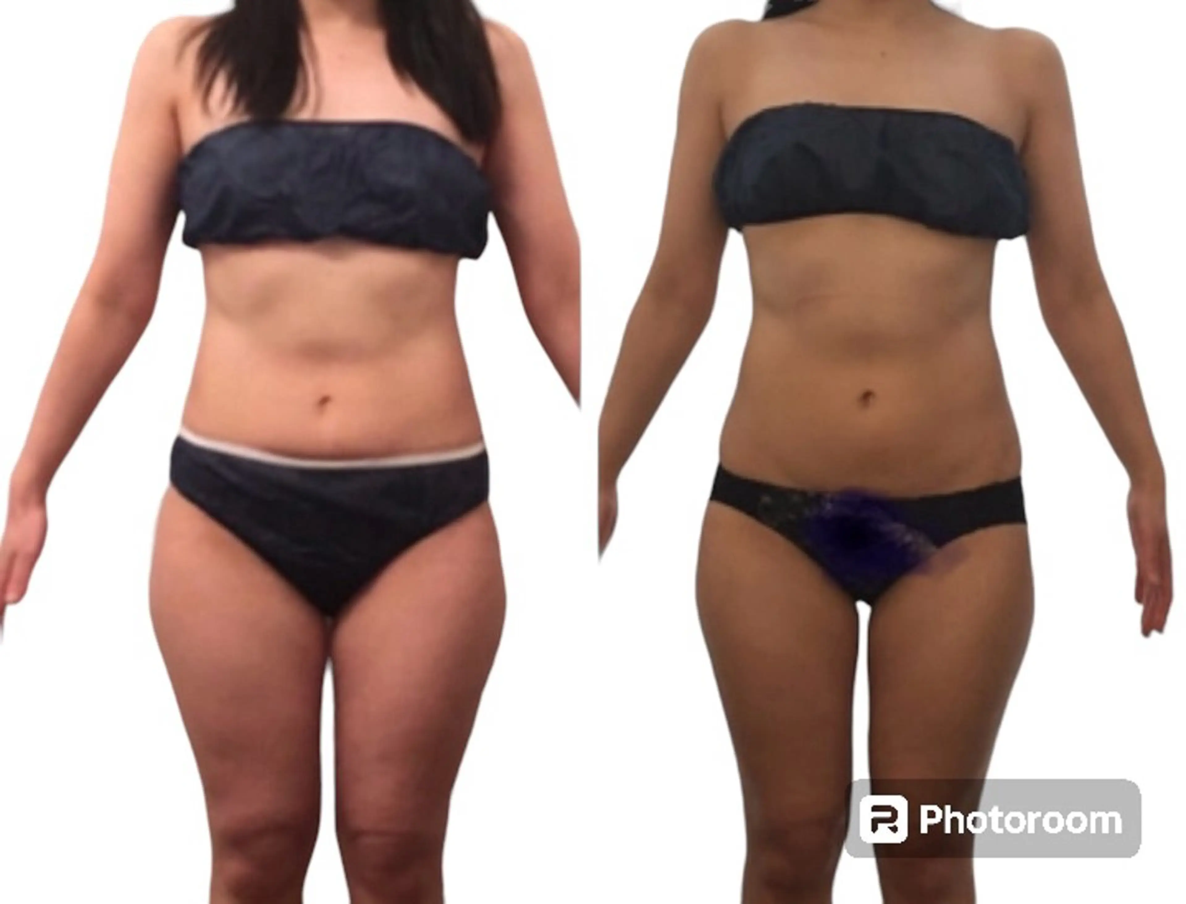 骨格美セラピーfuwari所属・fuwariオーナー じゅんこのエステ・リラクイメージ