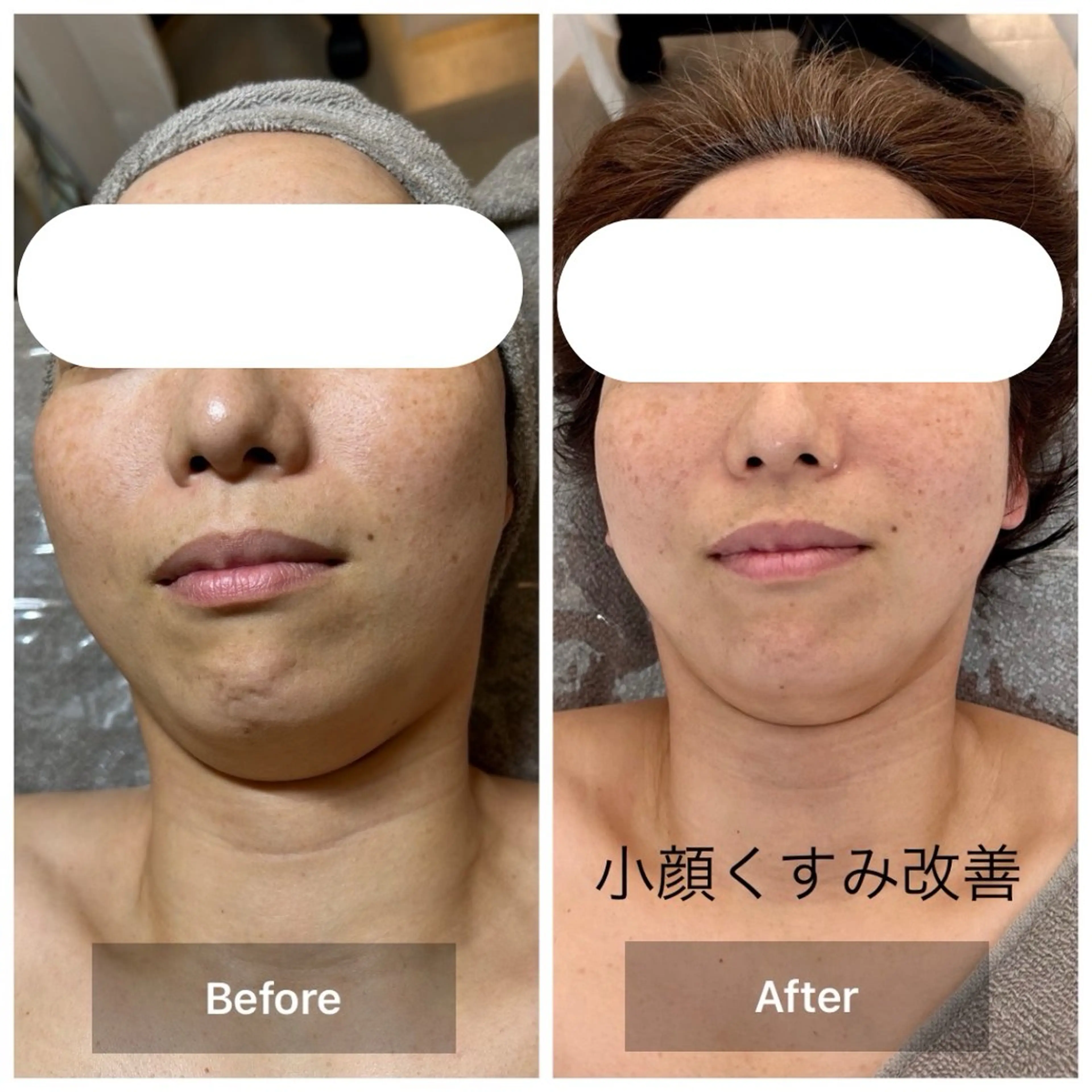 エステ リラク 目元・まつパ・美肌フ ェイシャル谷町四丁目のマツエク・マツパデザイン