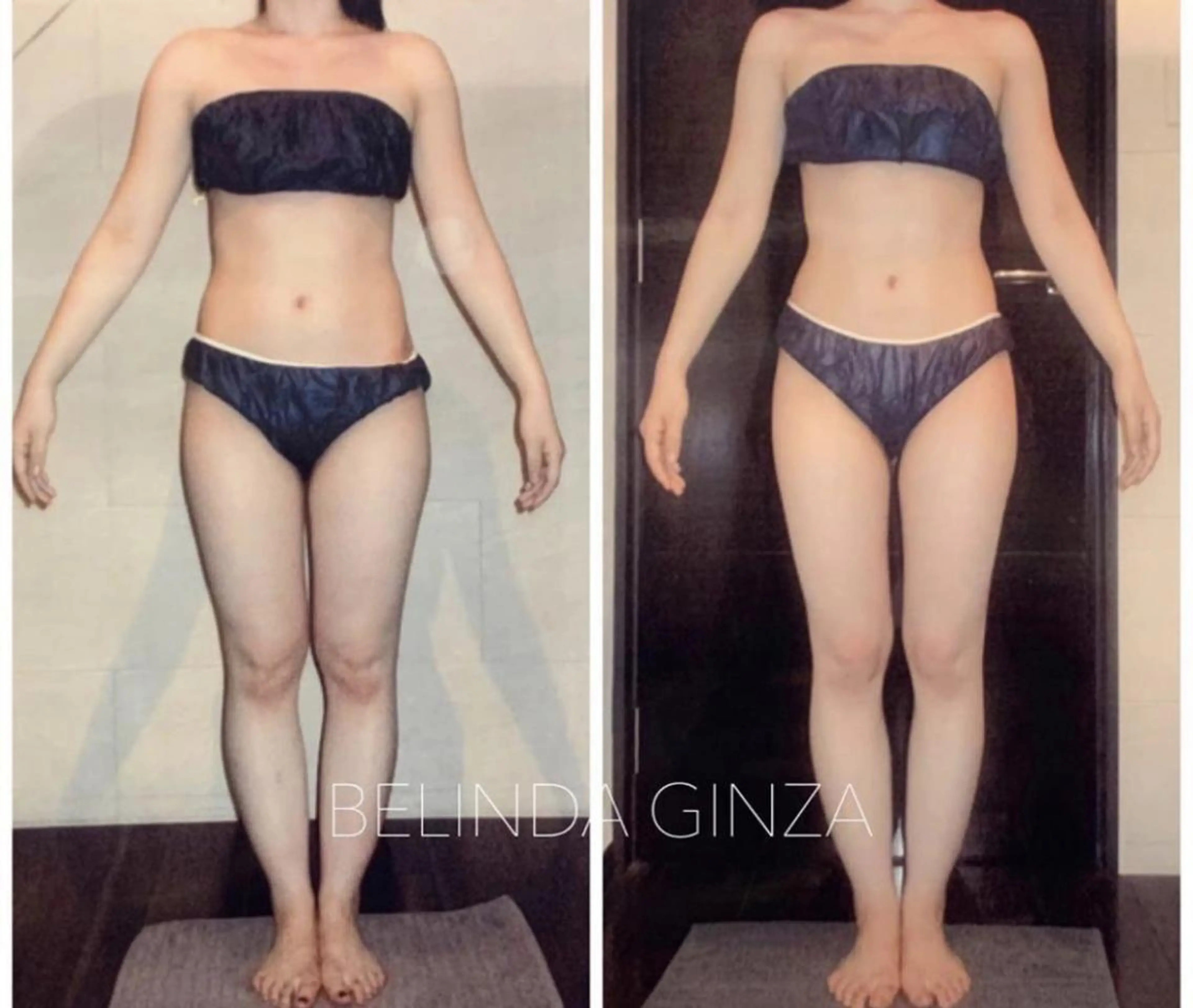 エステ BELINDA銀座店 ✨痩身エステサロン✨のエステ・リラクイメージ