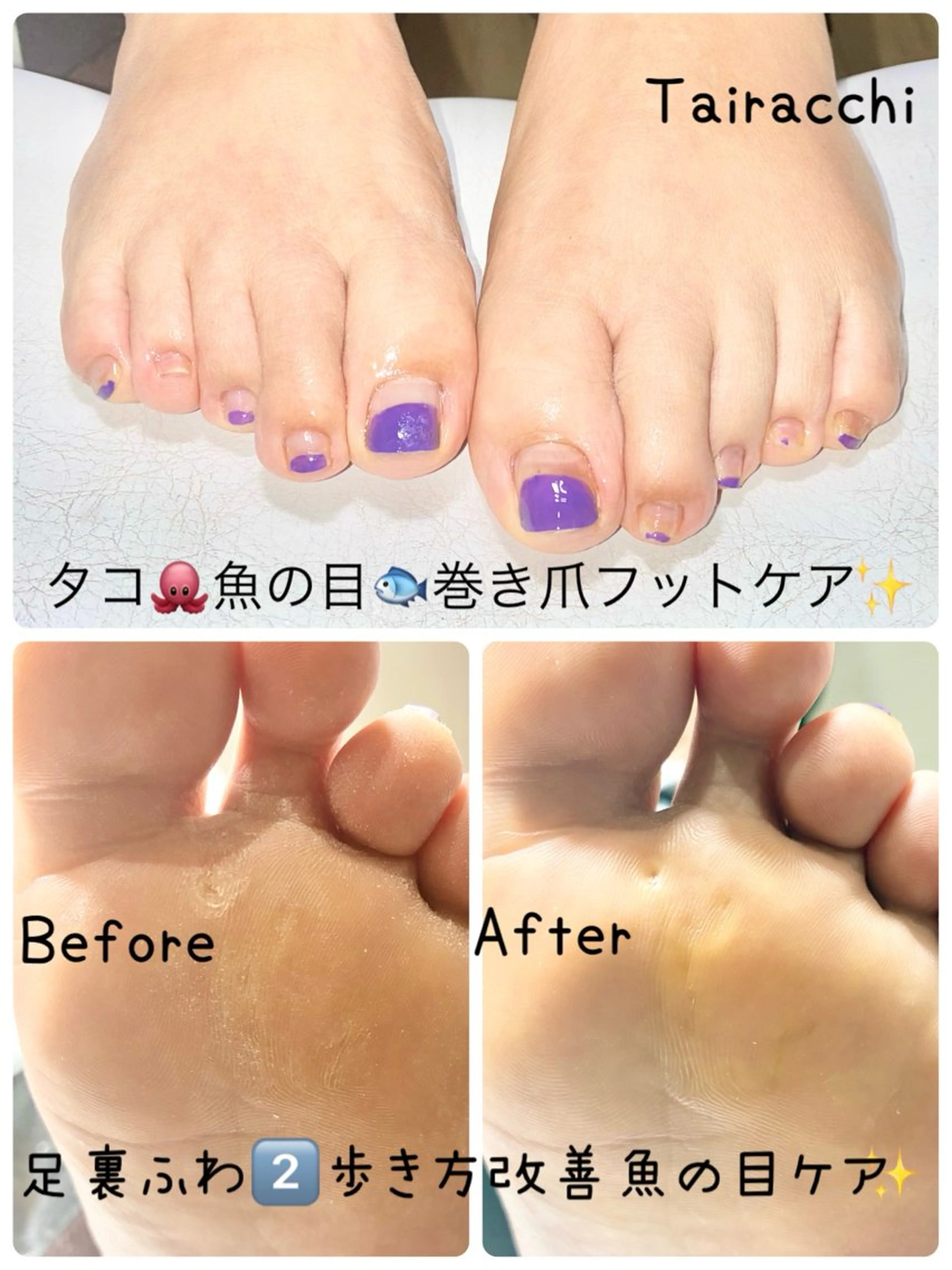 ネイル フットネイル フットネイル Tairacchi ﾀｲﾗｯﾁのエステ・リラクイメージ