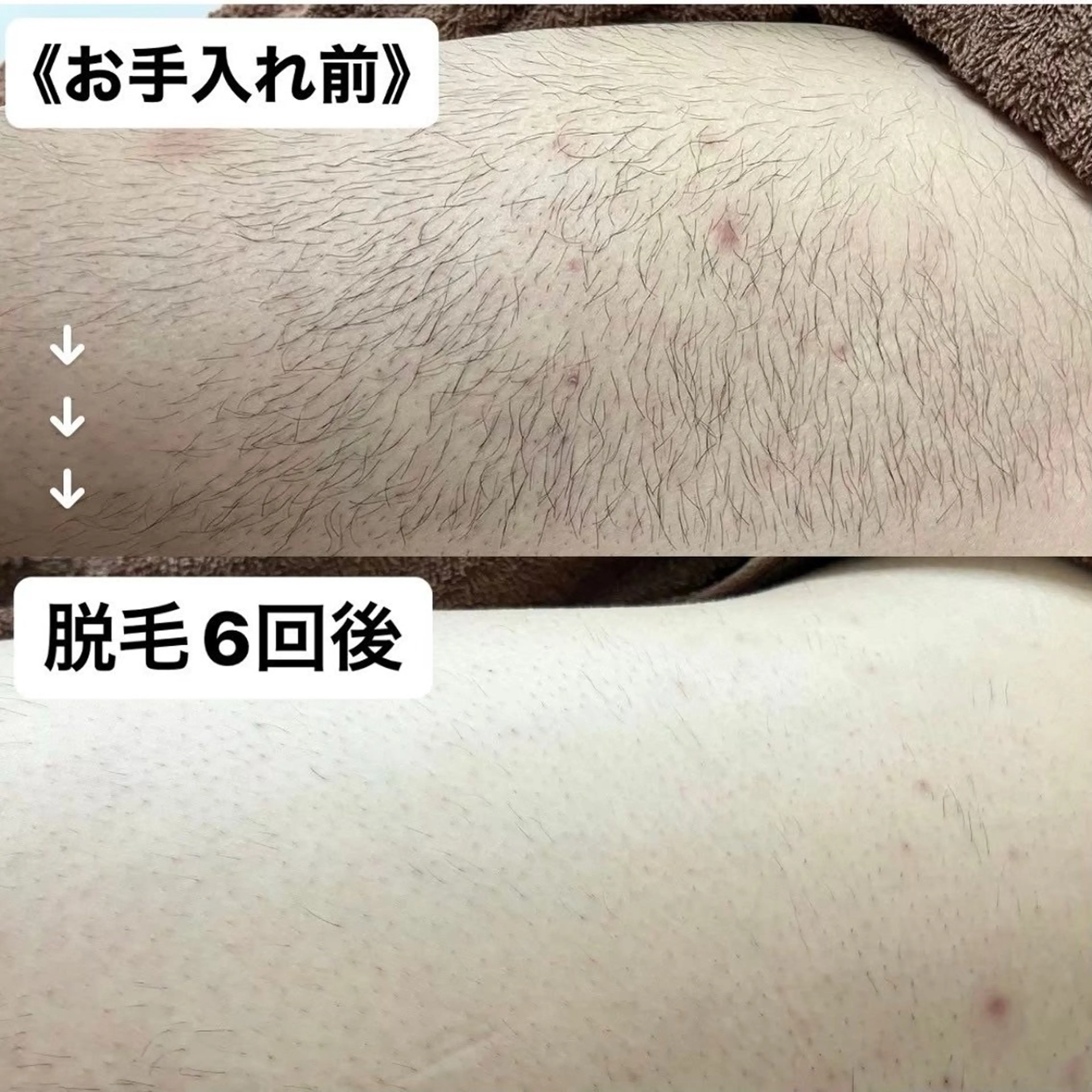 脱毛 MINOA熊本店所属・MINOA 熊本店のその他イメージ