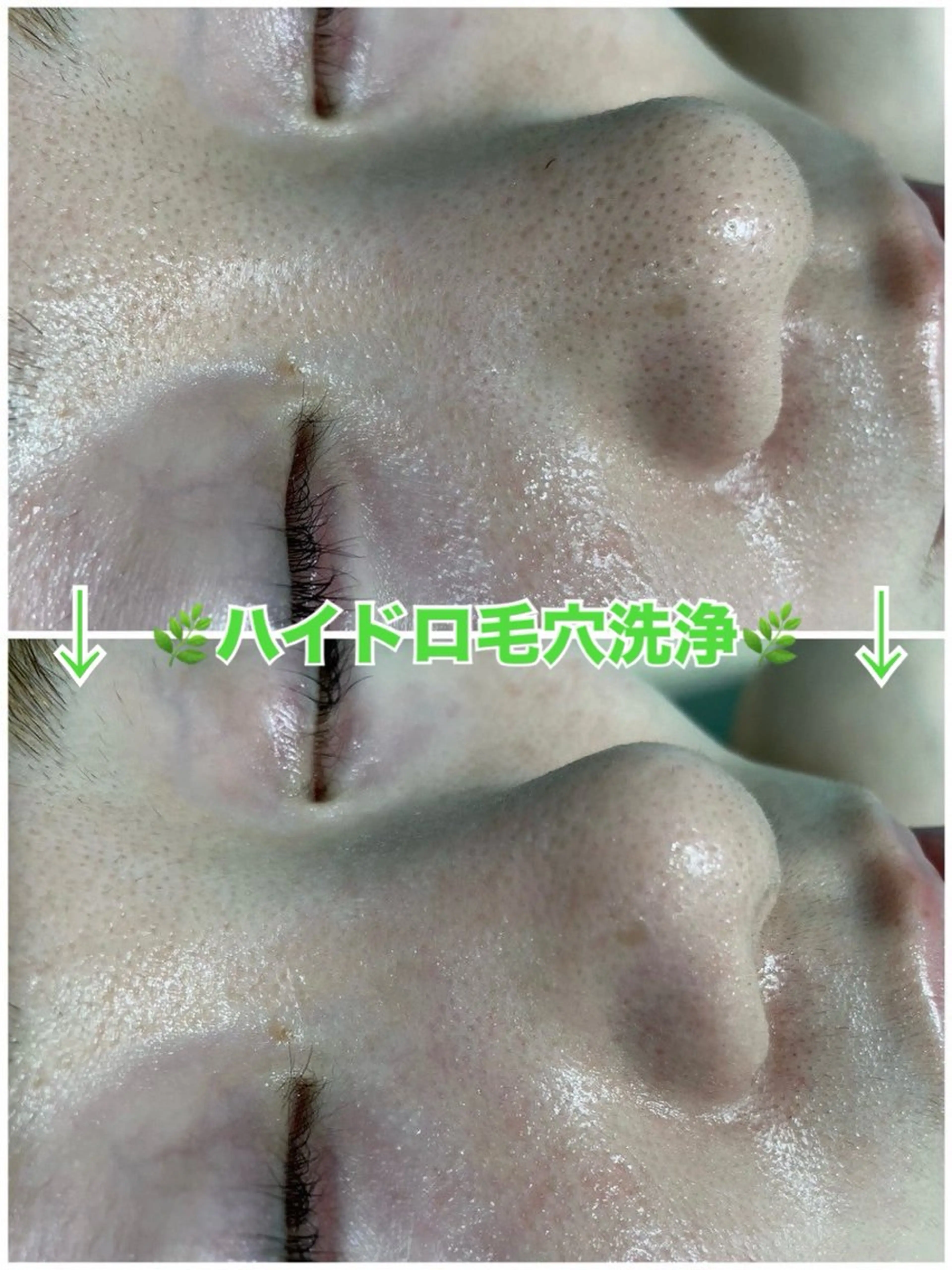 エステ 脱毛&美容サロン Dr.Epiのエステ・リラクイメージ