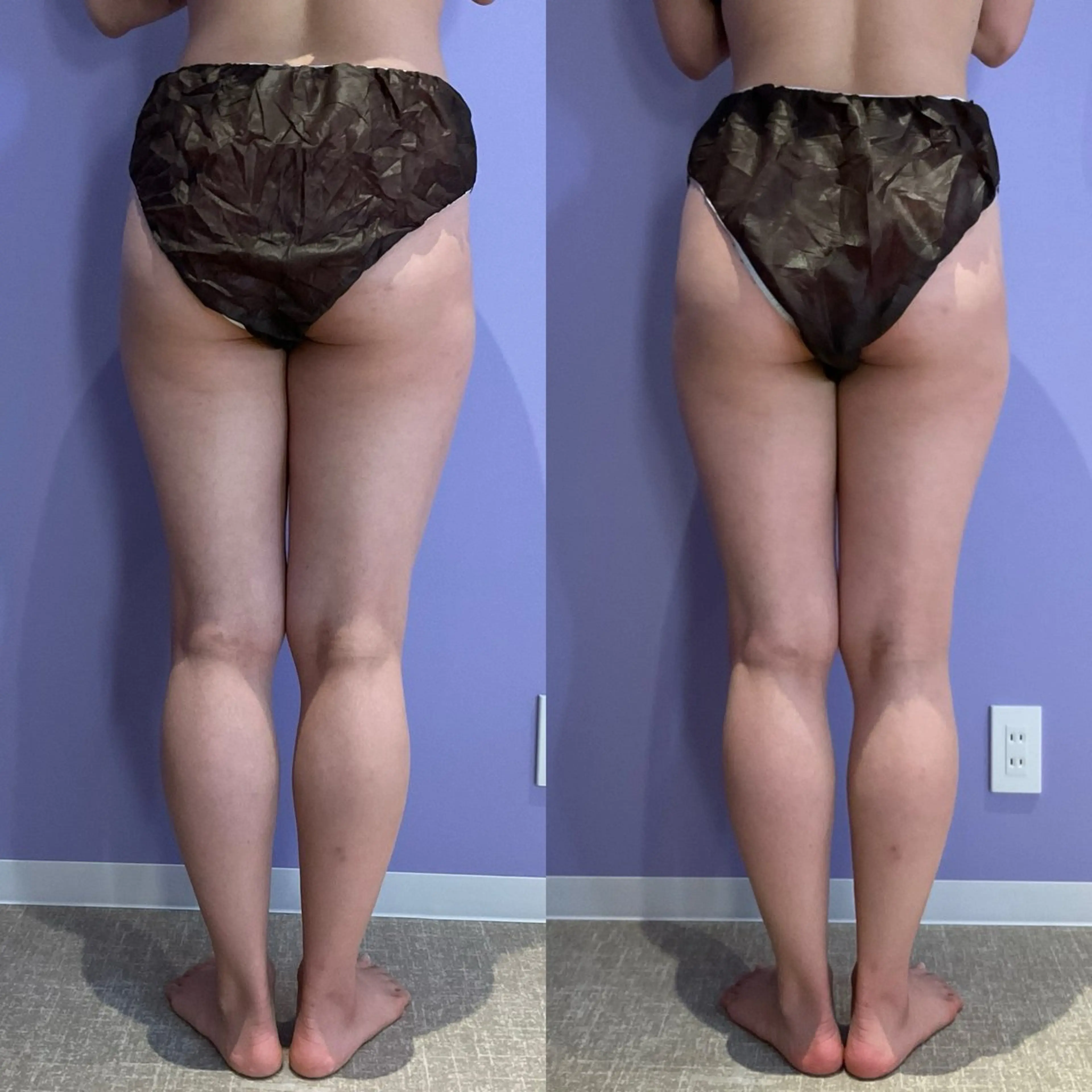 恵比寿/小顔/痩身 アプローズのエステ・リラクイメージ