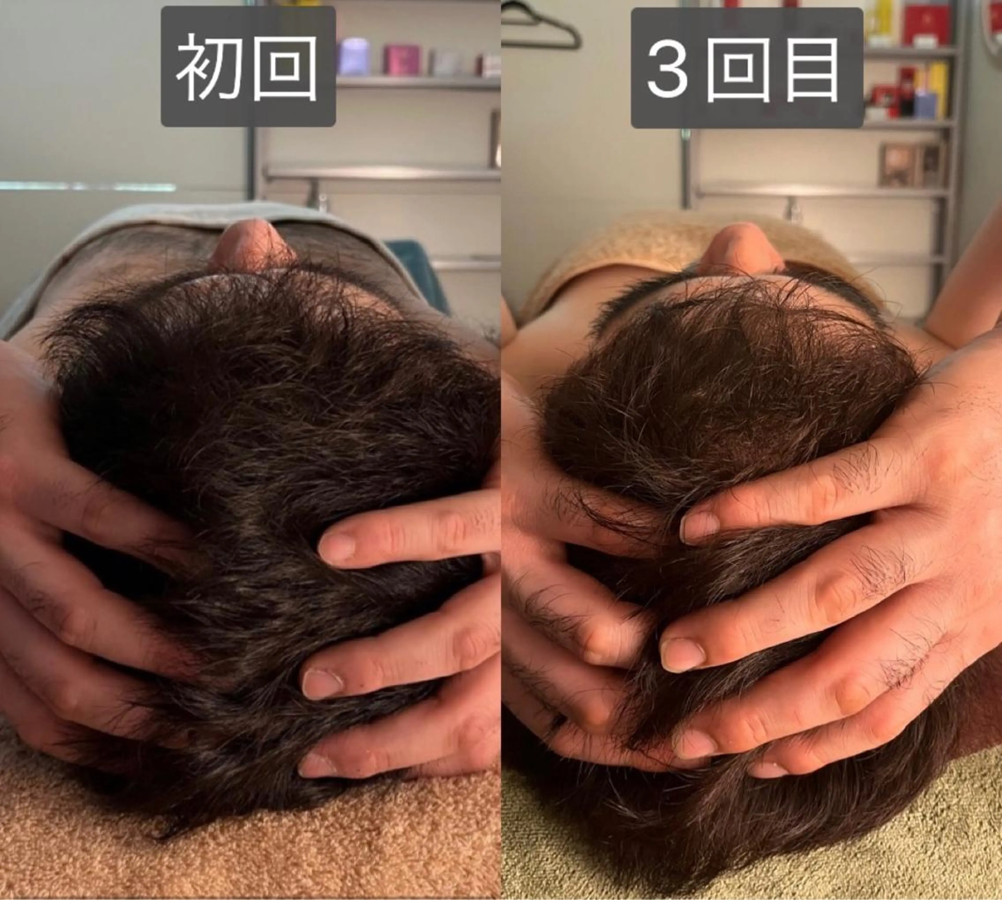 脳疲労改善！ヘッドスパ(70分)の写真