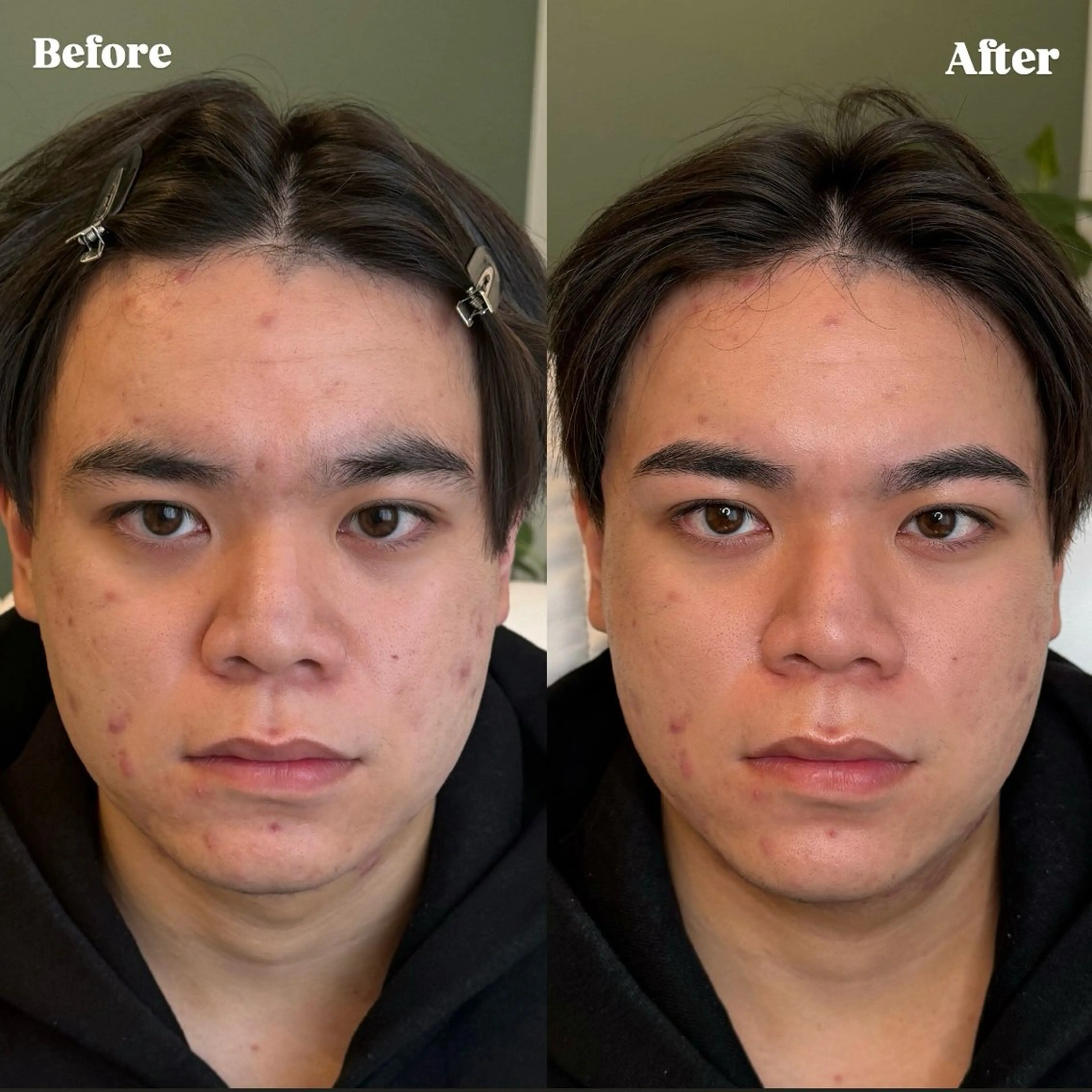 アイブロウ ワックス脱毛 その他(アイブロウ) Eyebrow salon 　Naiden所属・Naiden/ ユリ🎀の眉毛・アイブロウイメージ