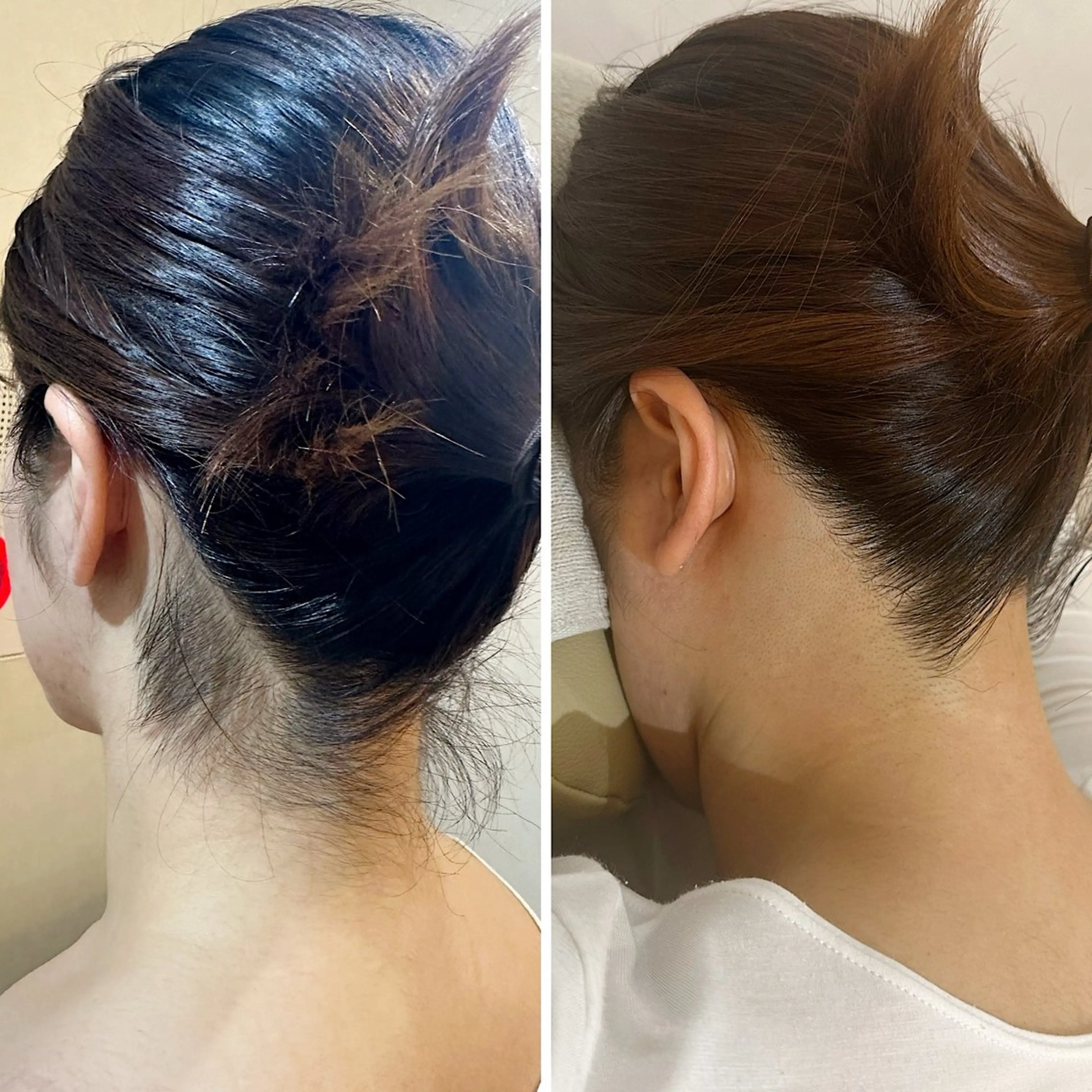 脱毛 うなじ脱毛/美肌脱毛 LABELのエステ・リラクイメージ