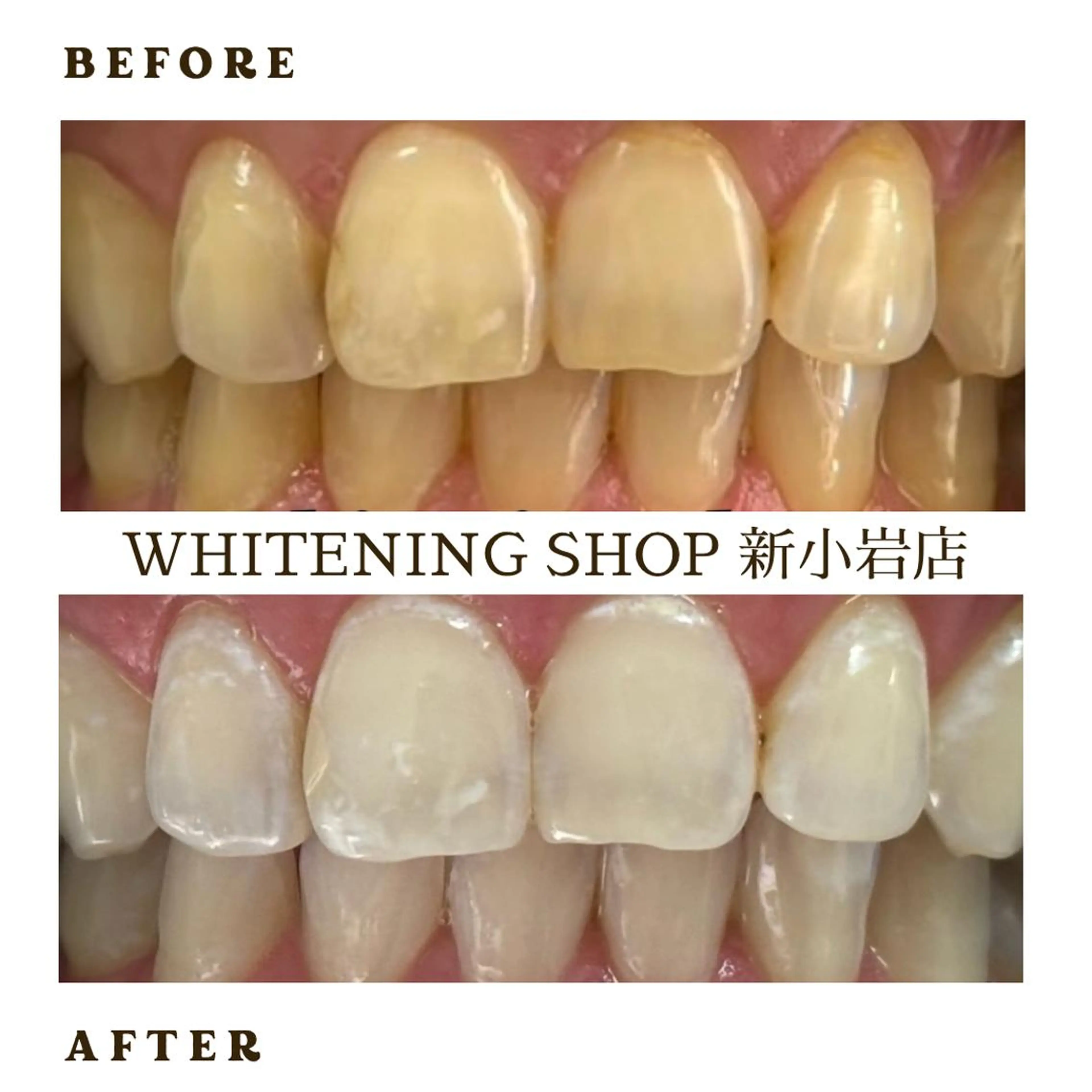 メンズ その他 ホワイトニング ショップ新小岩店のその他イメージ