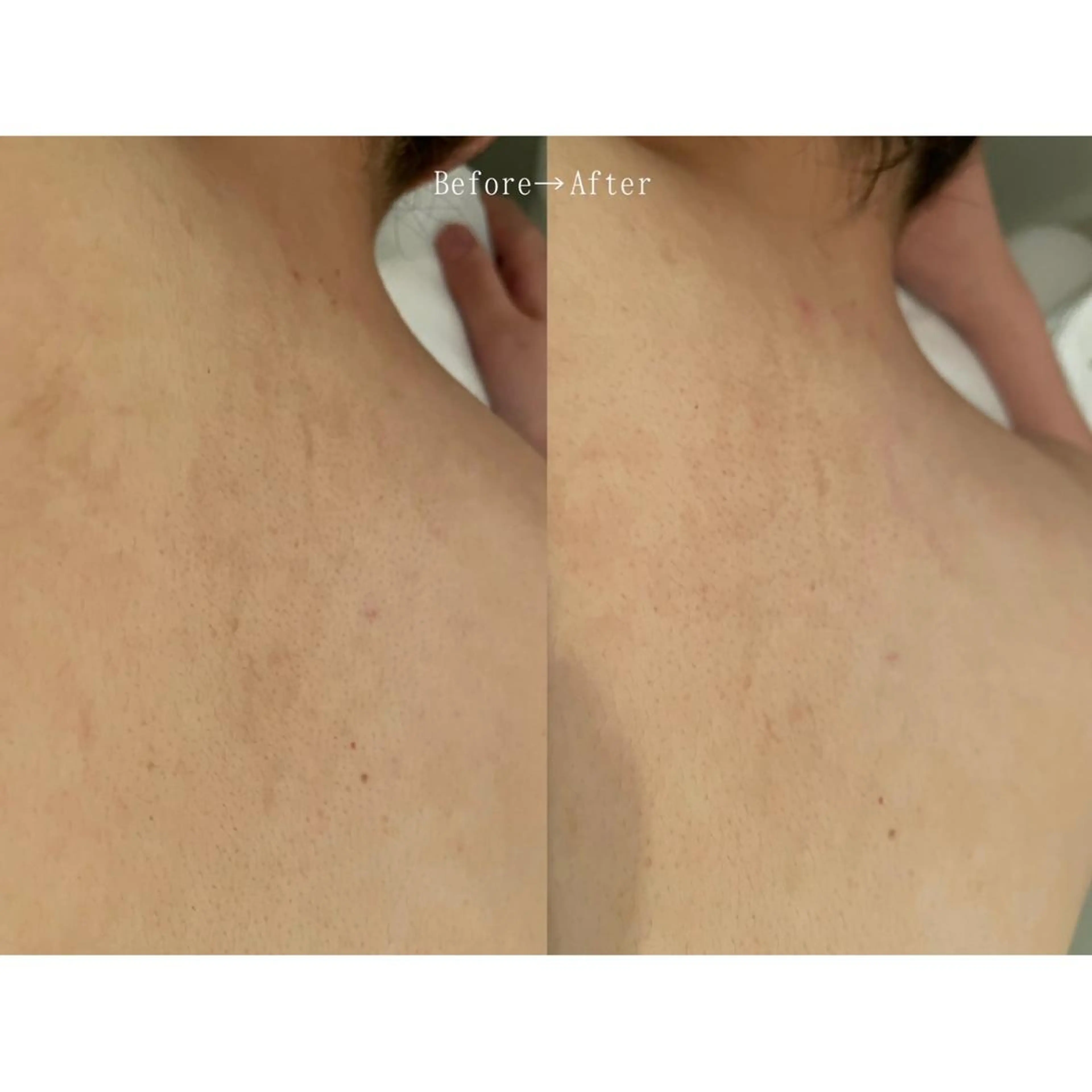 エステ リラク 杉浦里沙⌇ 居心地いいエステのエステ・リラクイメージ