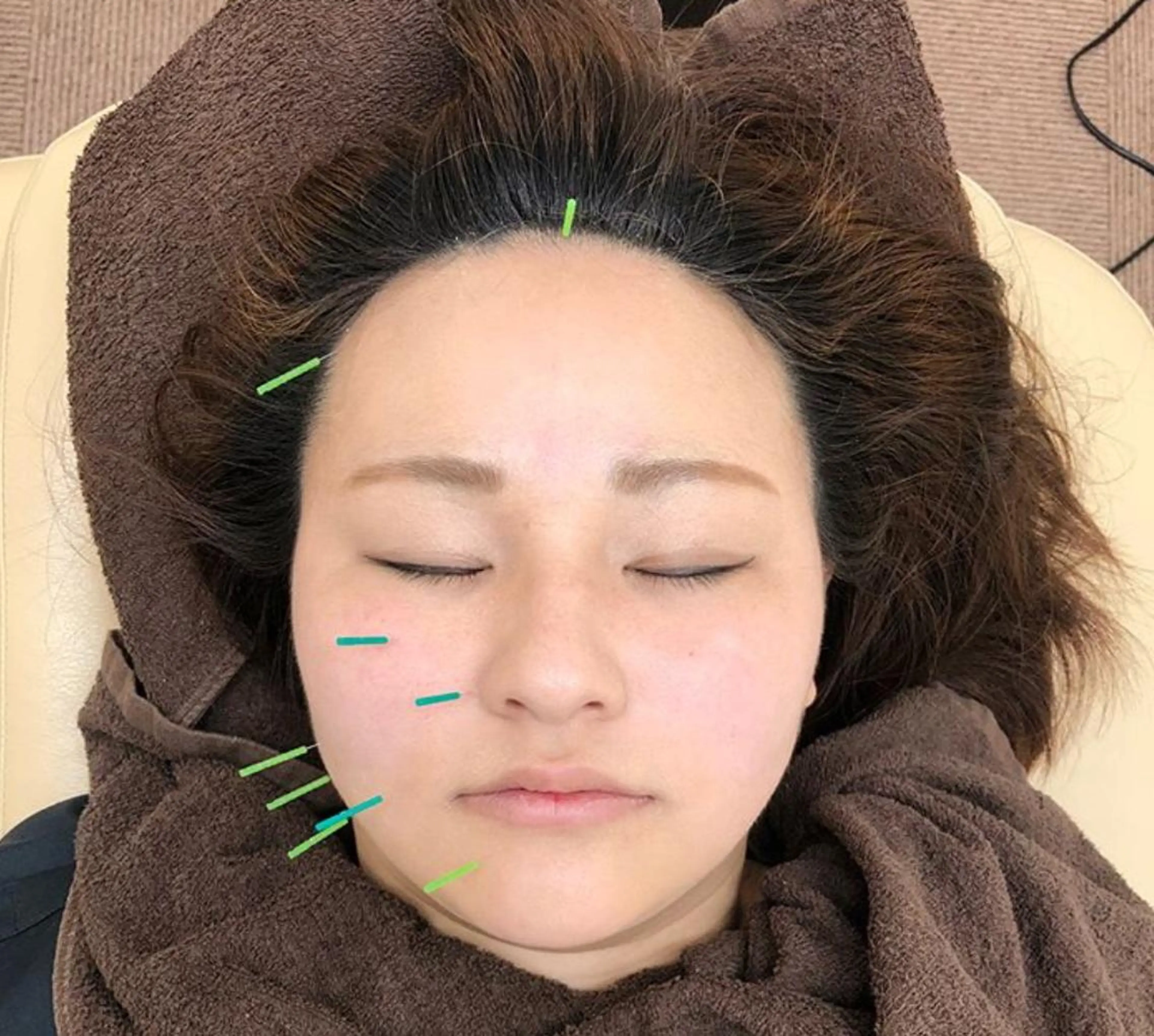 エステ リラク まごころ鍼灸整骨院所属・まごころ鍼灸整骨院 京王堀之内院のエステ・リラクイメージ