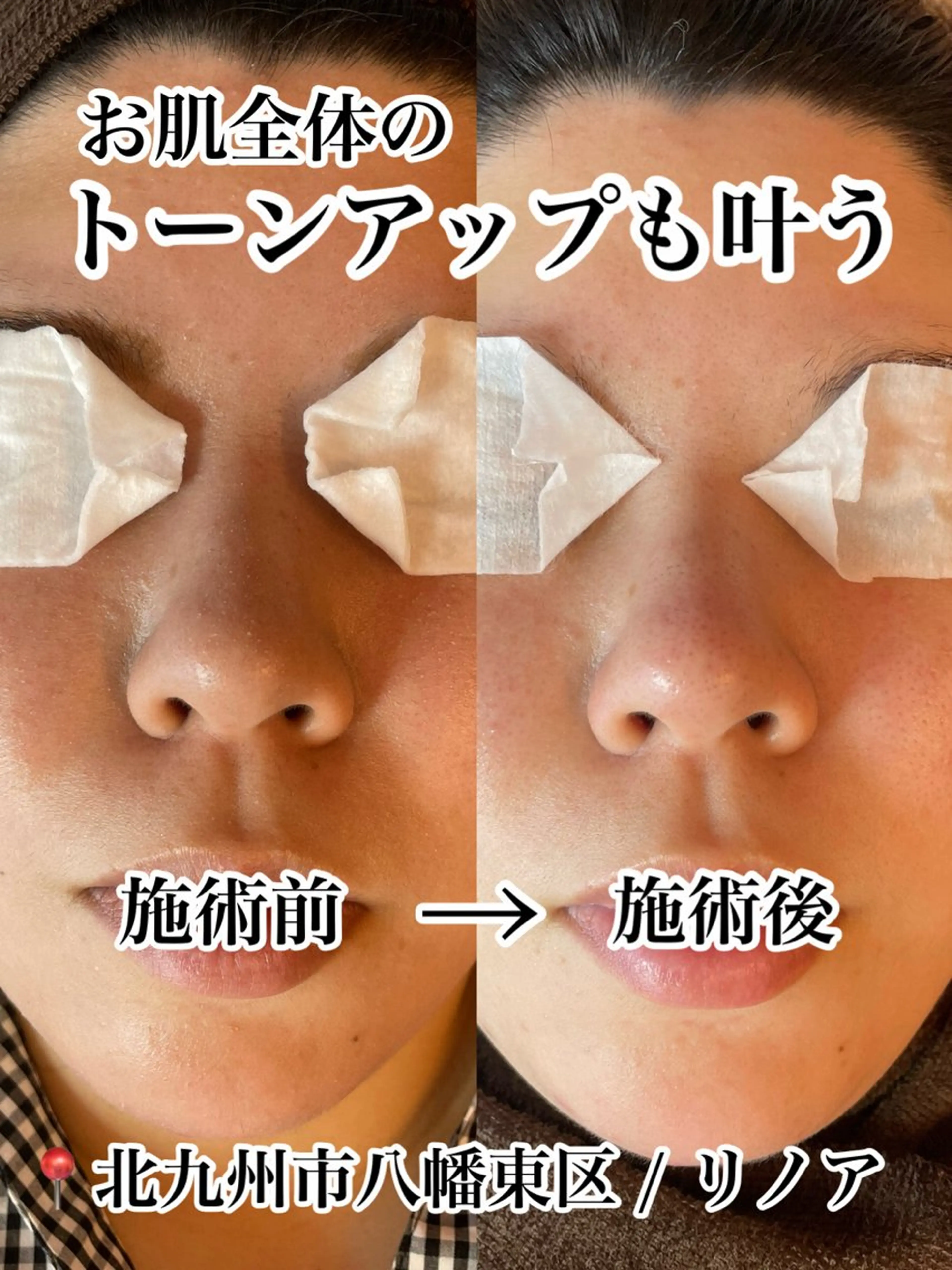 プライベートサロン Linoaのマツエク・マツパデザイン