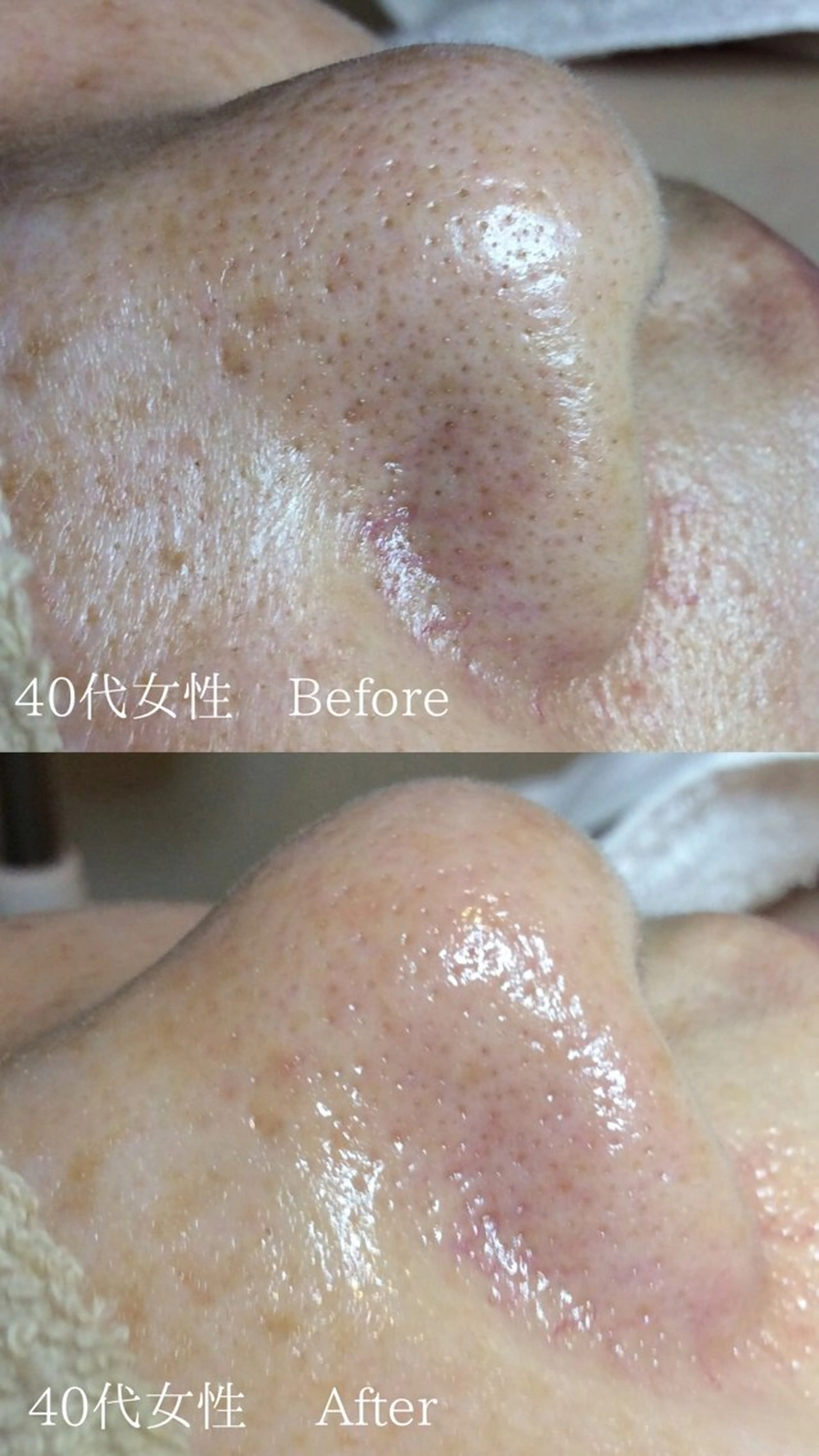 エステ エステサロン Lazulisea所属・川口 春奈のエステ・リラクイメージ