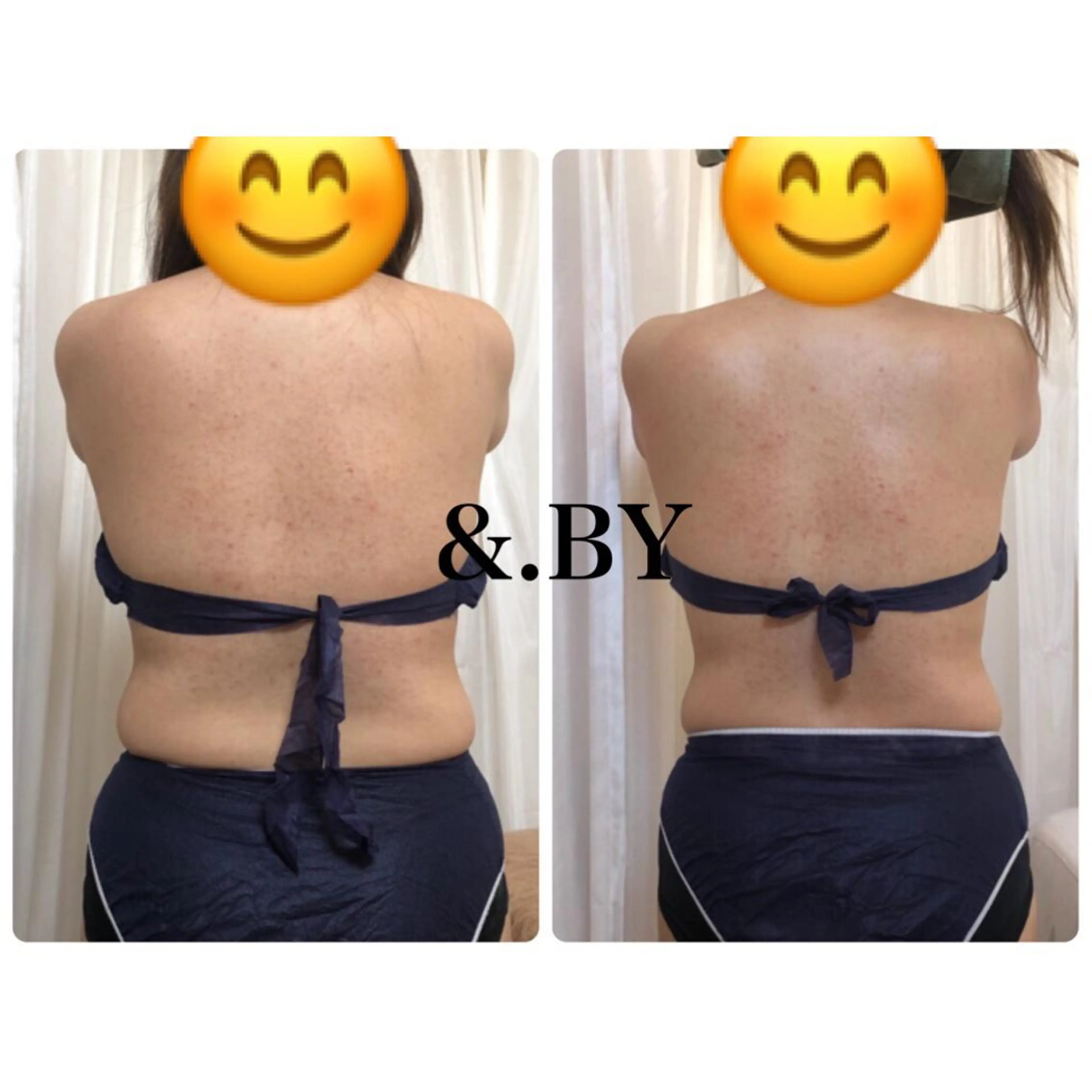 &. BYのエステ・リラクイメージ