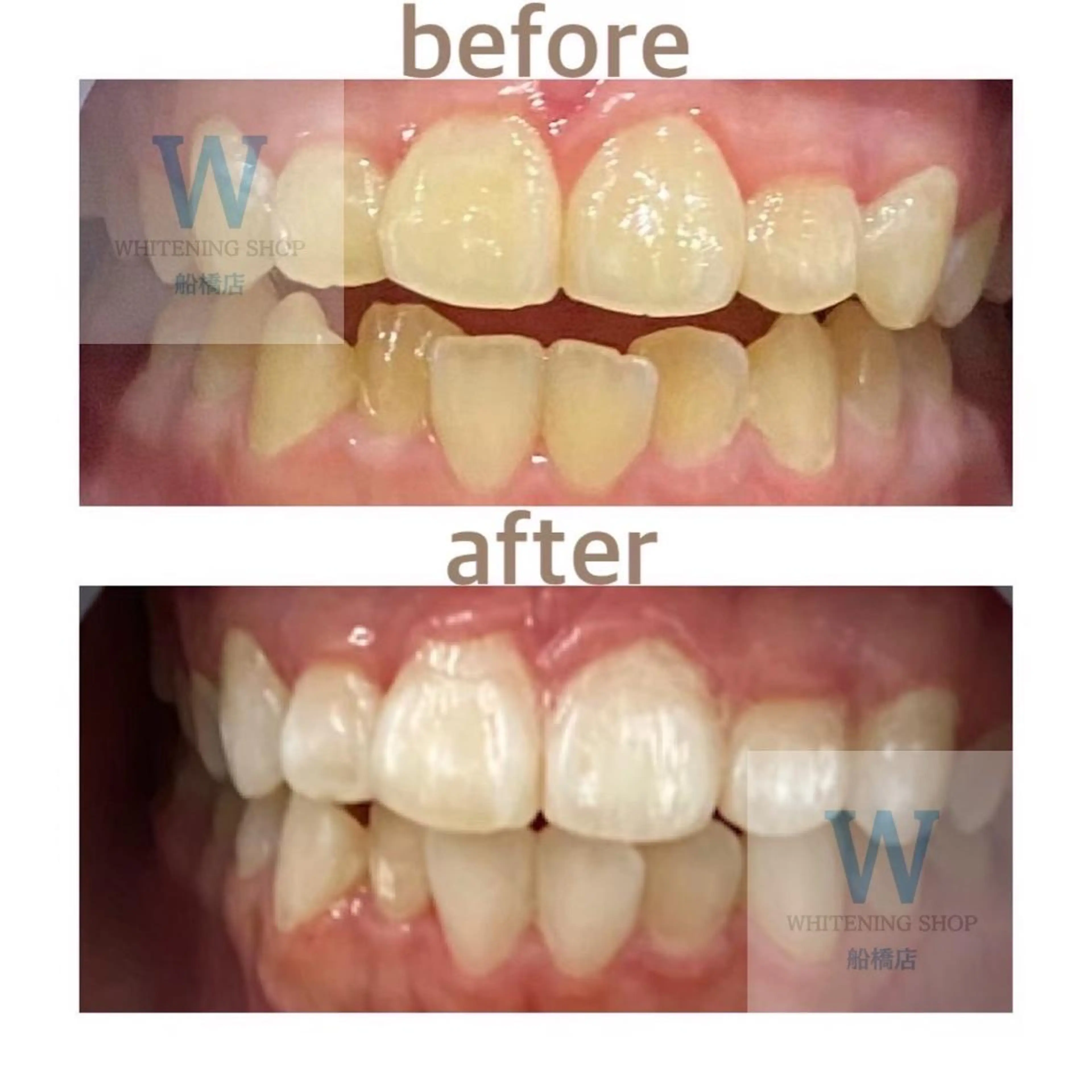 エステ リラク ホワイトニング ショップ船橋店🦷のエステ・リラクイメージ