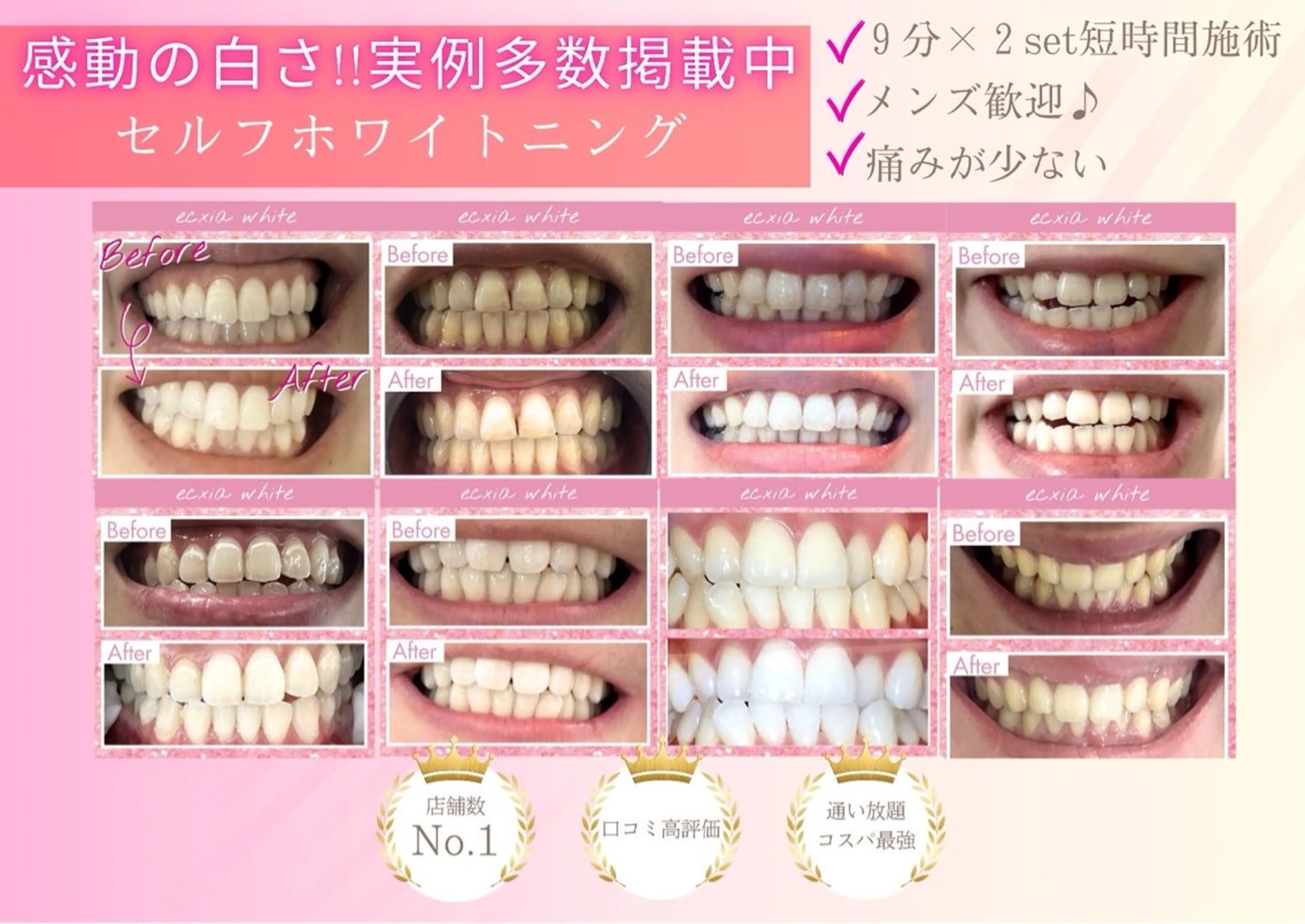 その他 セルフホワイトニング エクシア浜松店のその他イメージ