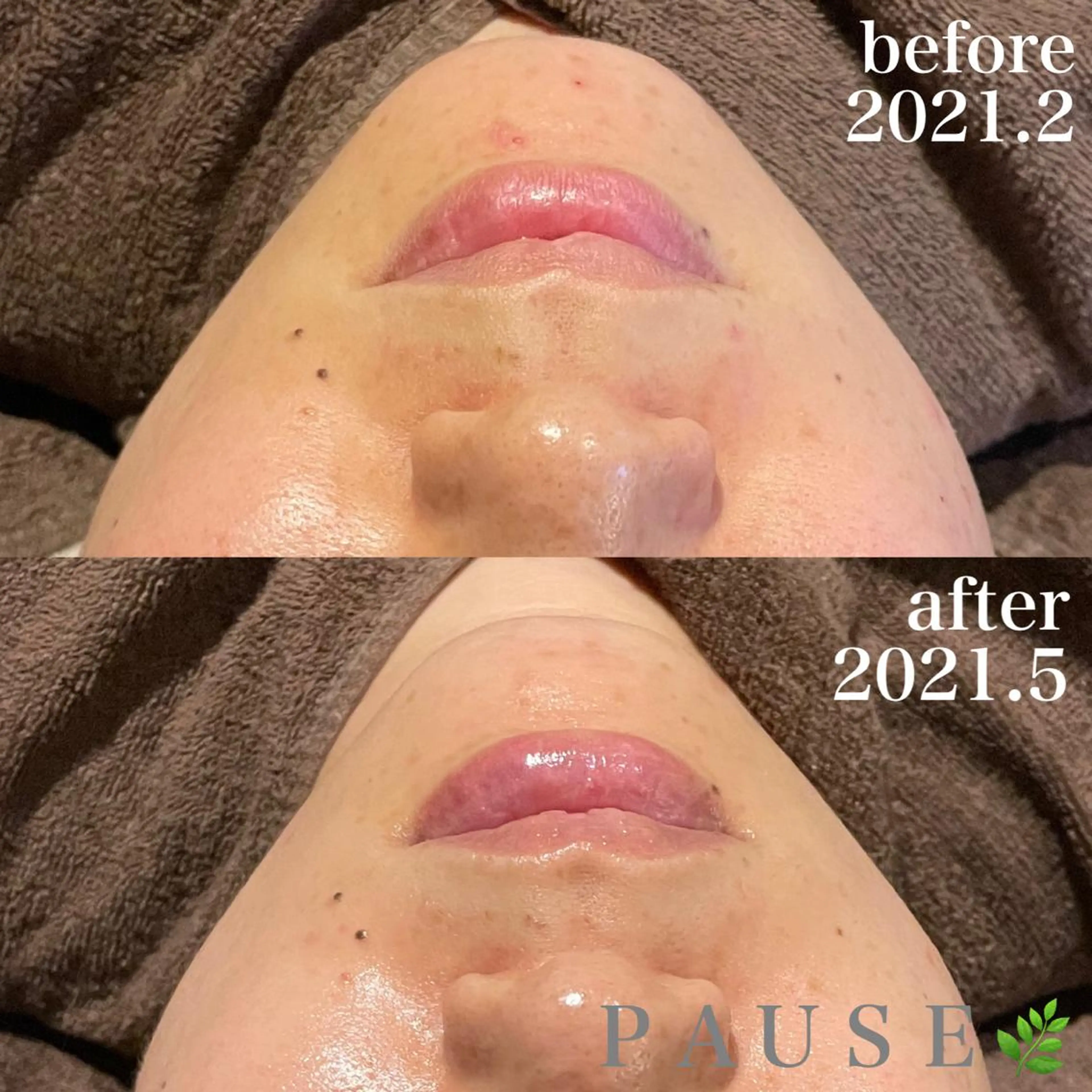 エステ 浜野 恵美のエステ・リラクイメージ