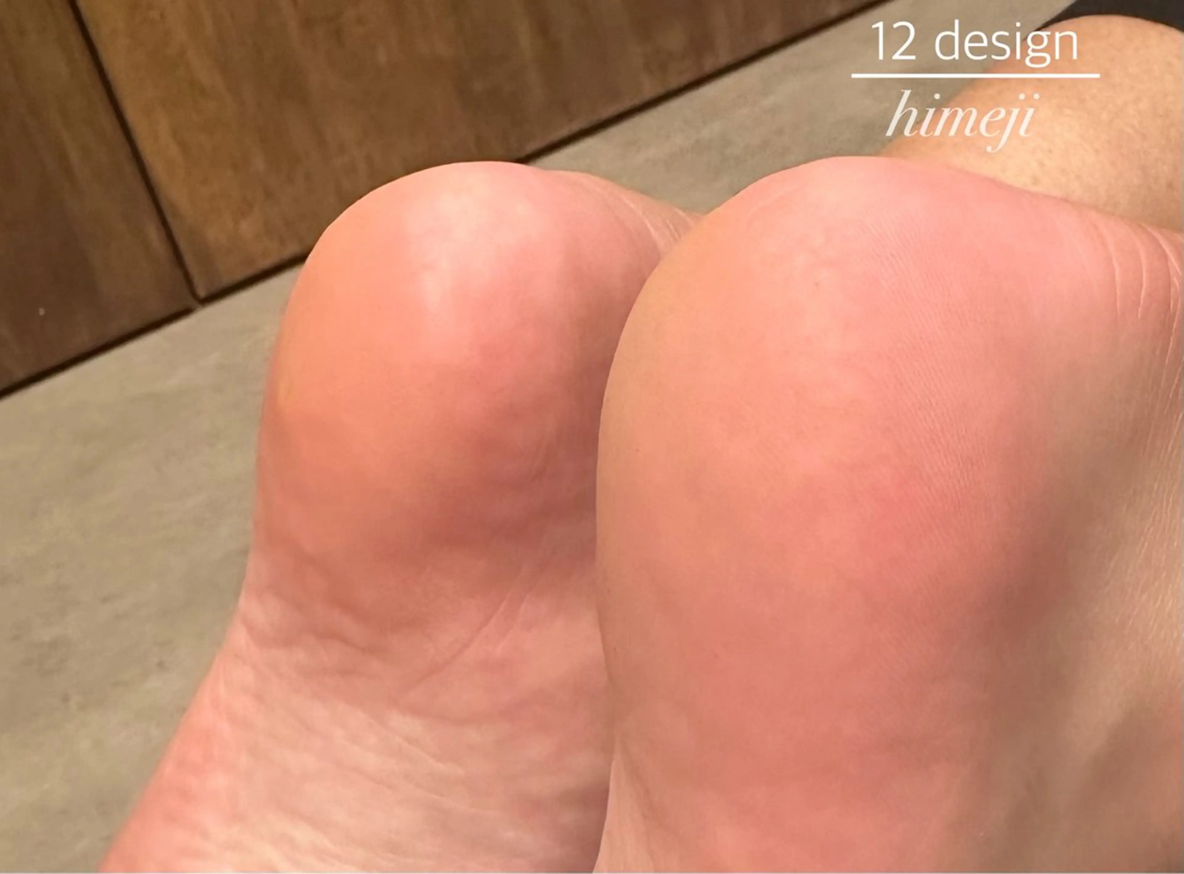 フット角質除去の写真