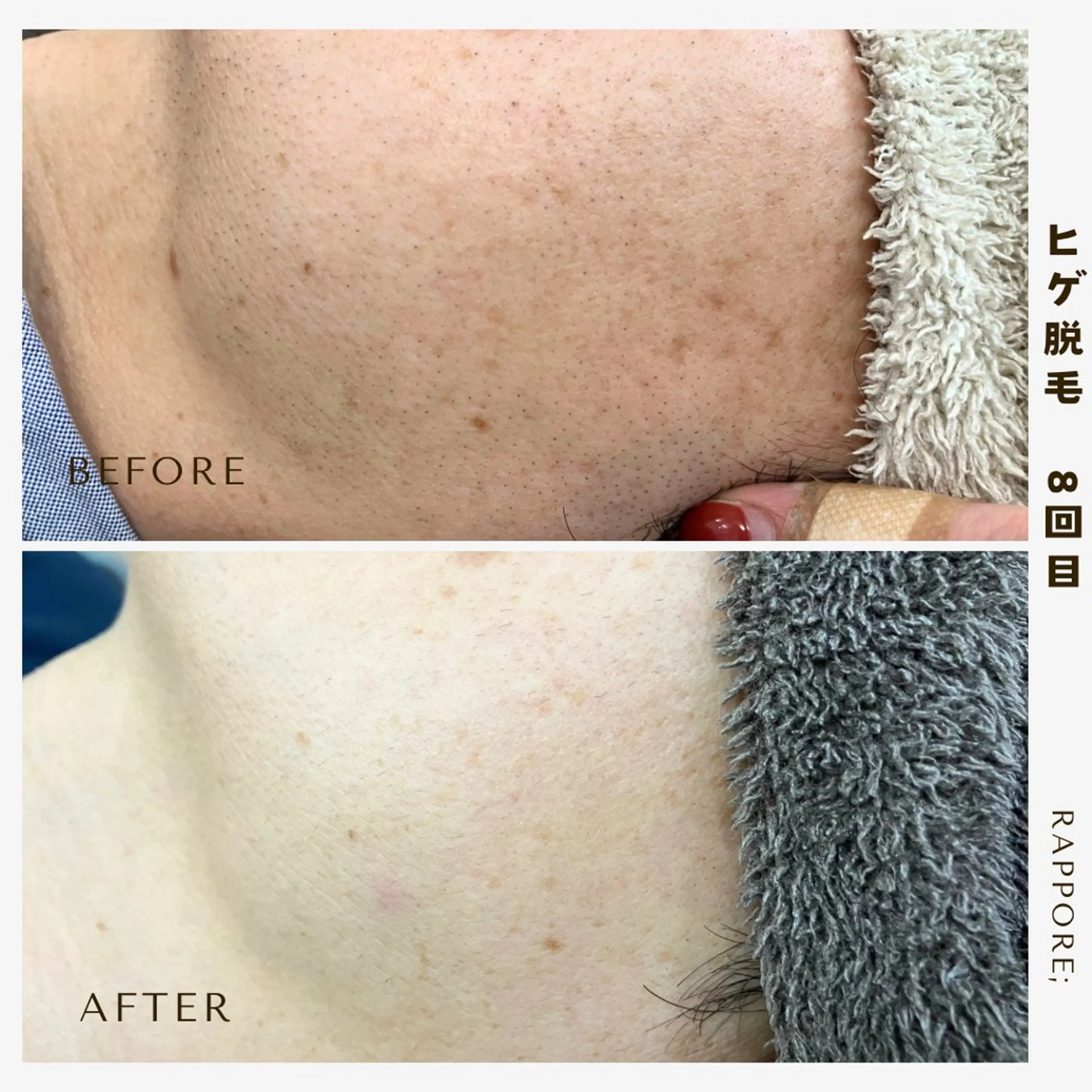 メンズ Rappore; 心斎橋　みずきのエステ・リラクイメージ