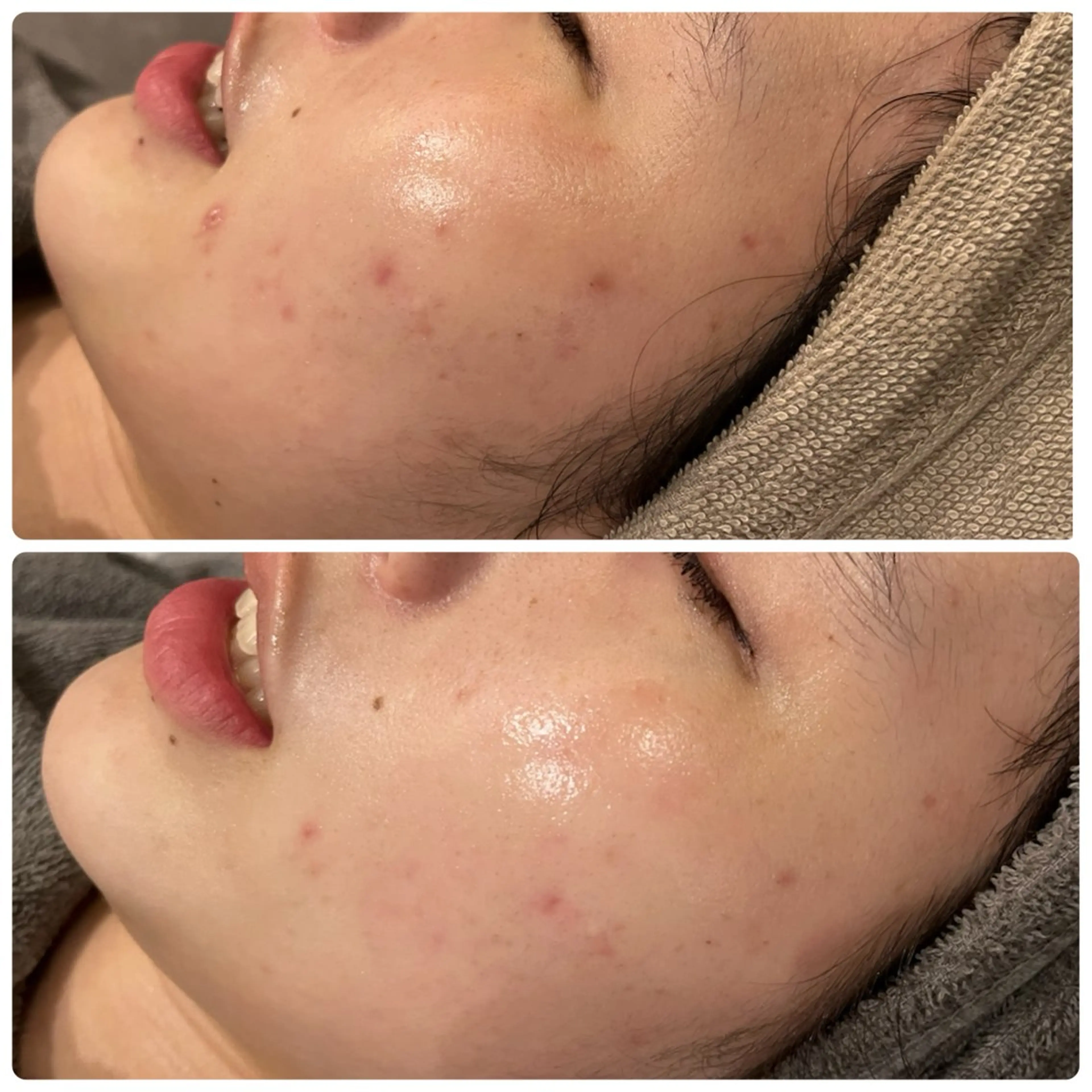 脱毛 yellow💛【 脱毛&フェイシャル】のエステ・リラクイメージ