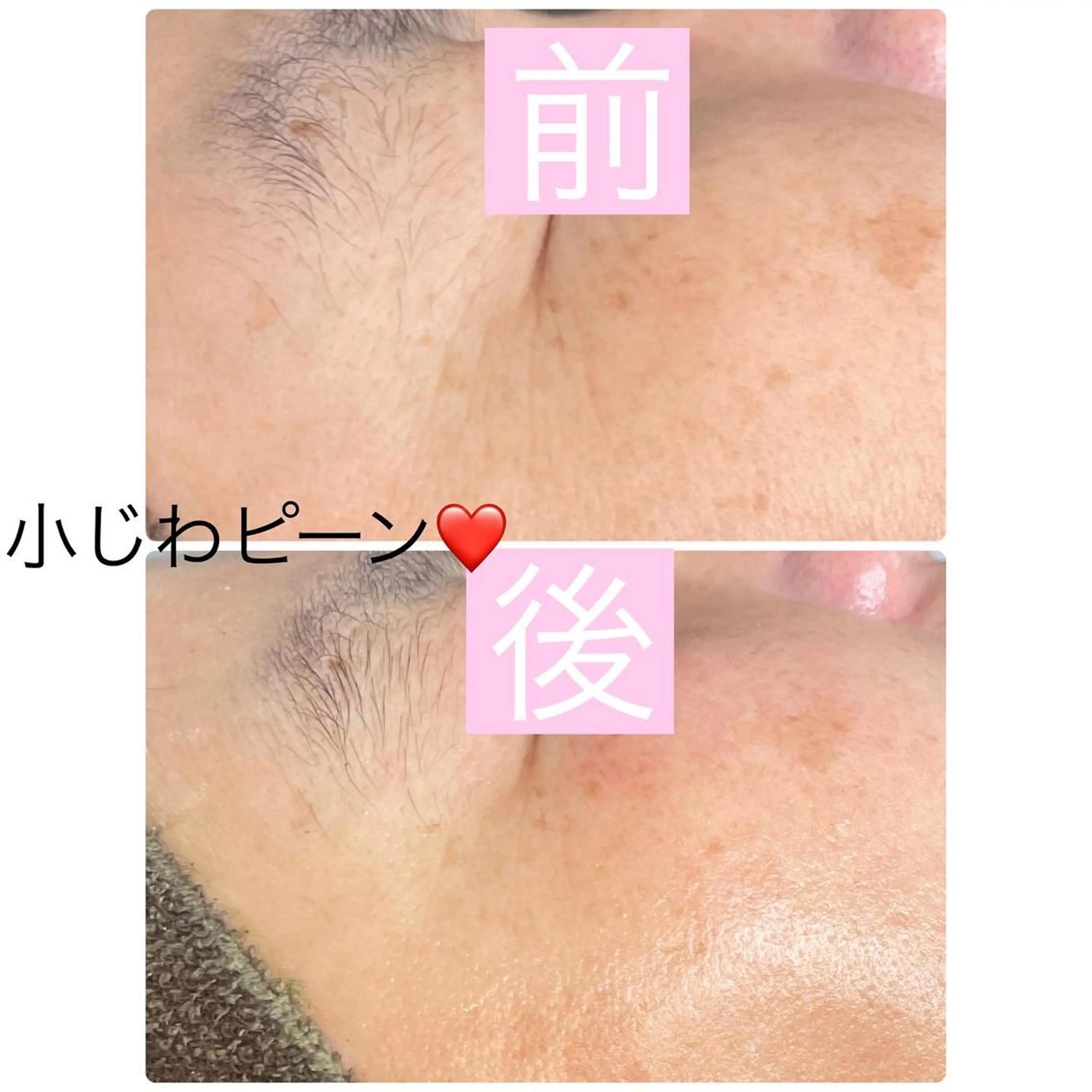 メンズ エステ 肌育脱毛サロン LikoLinaのその他イメージ