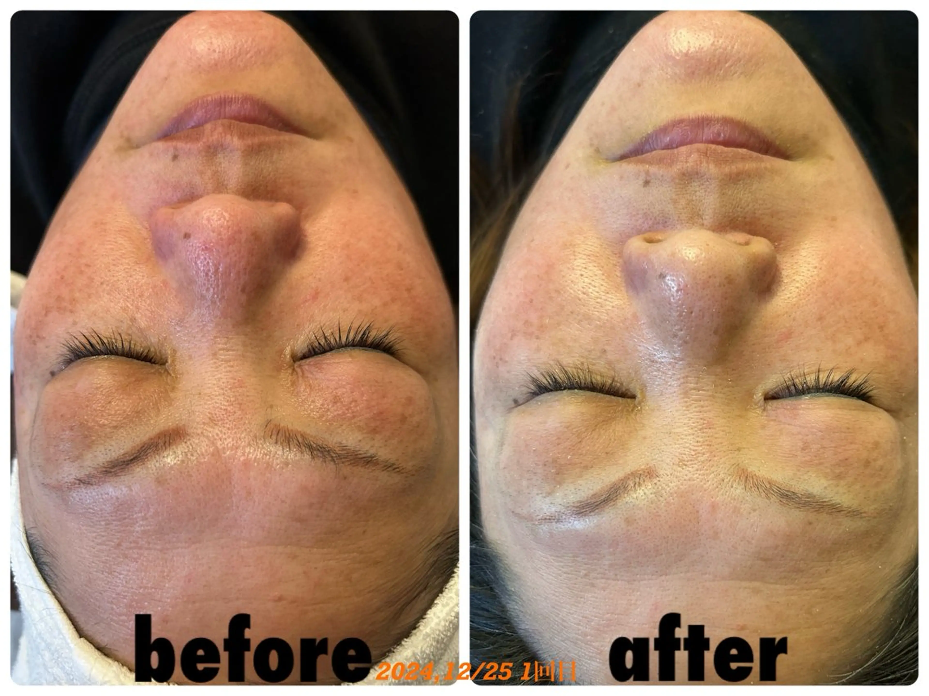 ÉMIA ✴︎のエステ・リラクイメージ