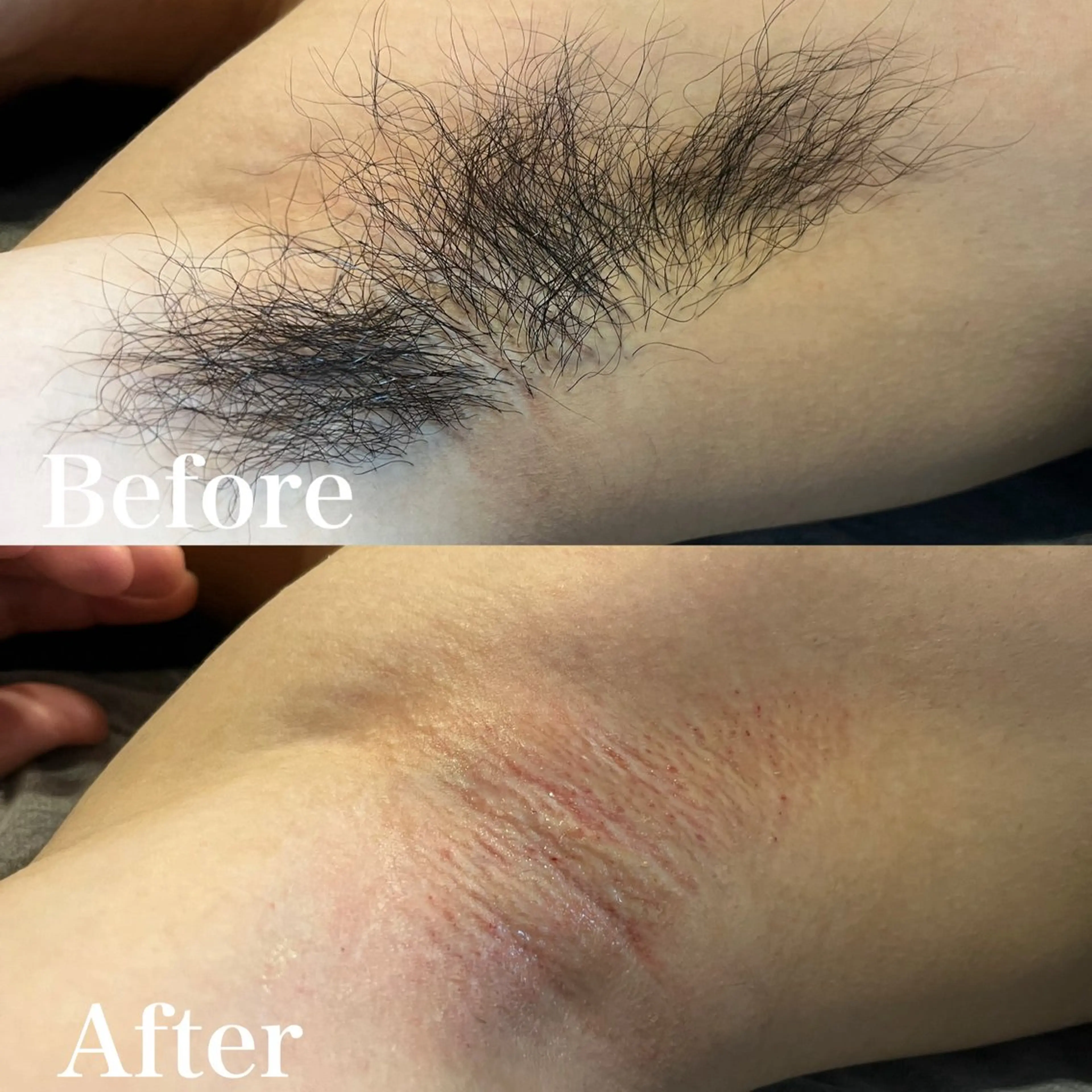 メンズ 脱毛 wax脱毛専門店 ハイラントのエステ・リラクイメージ