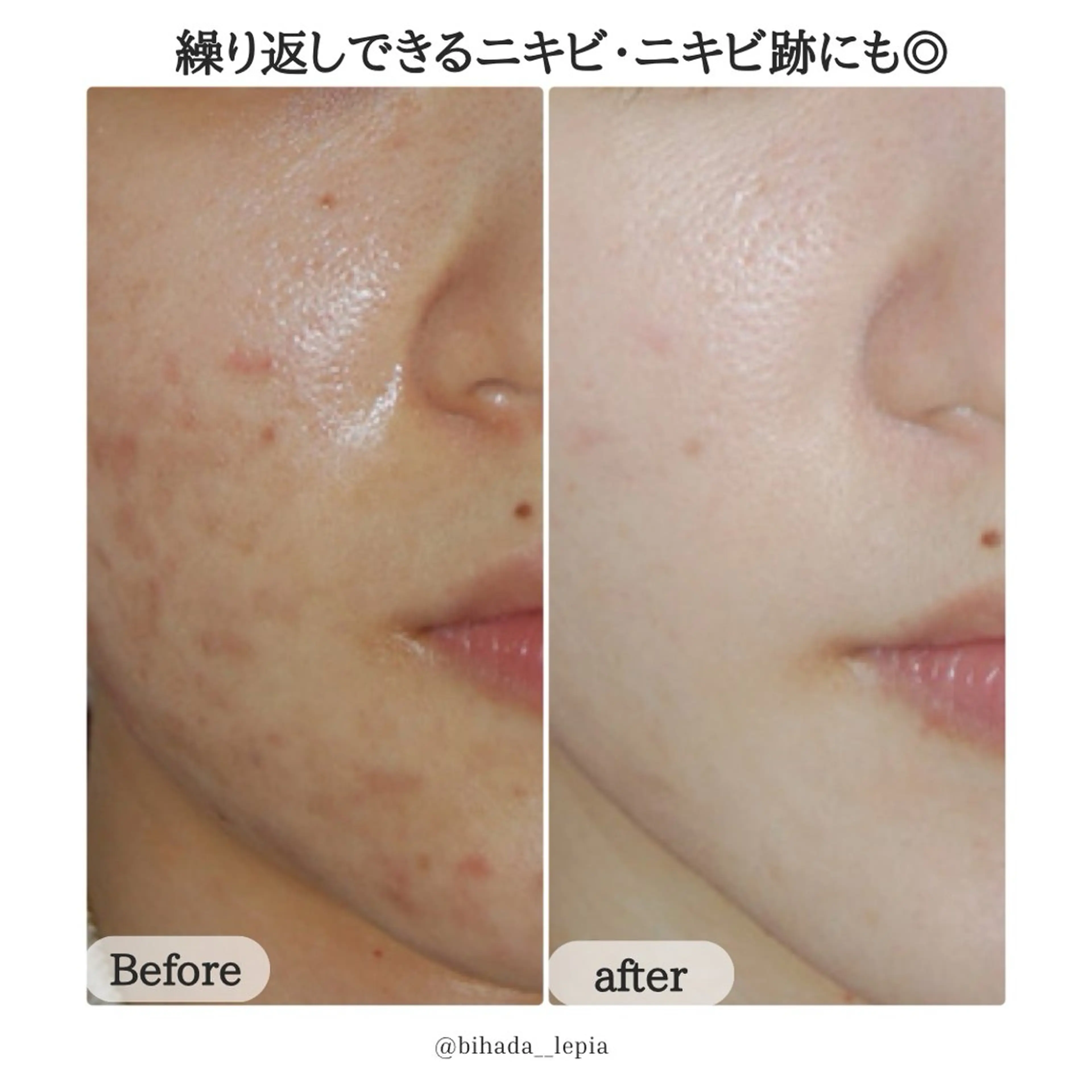 肌質管理専門店 Lé pia　AMIのエステ・リラクイメージ