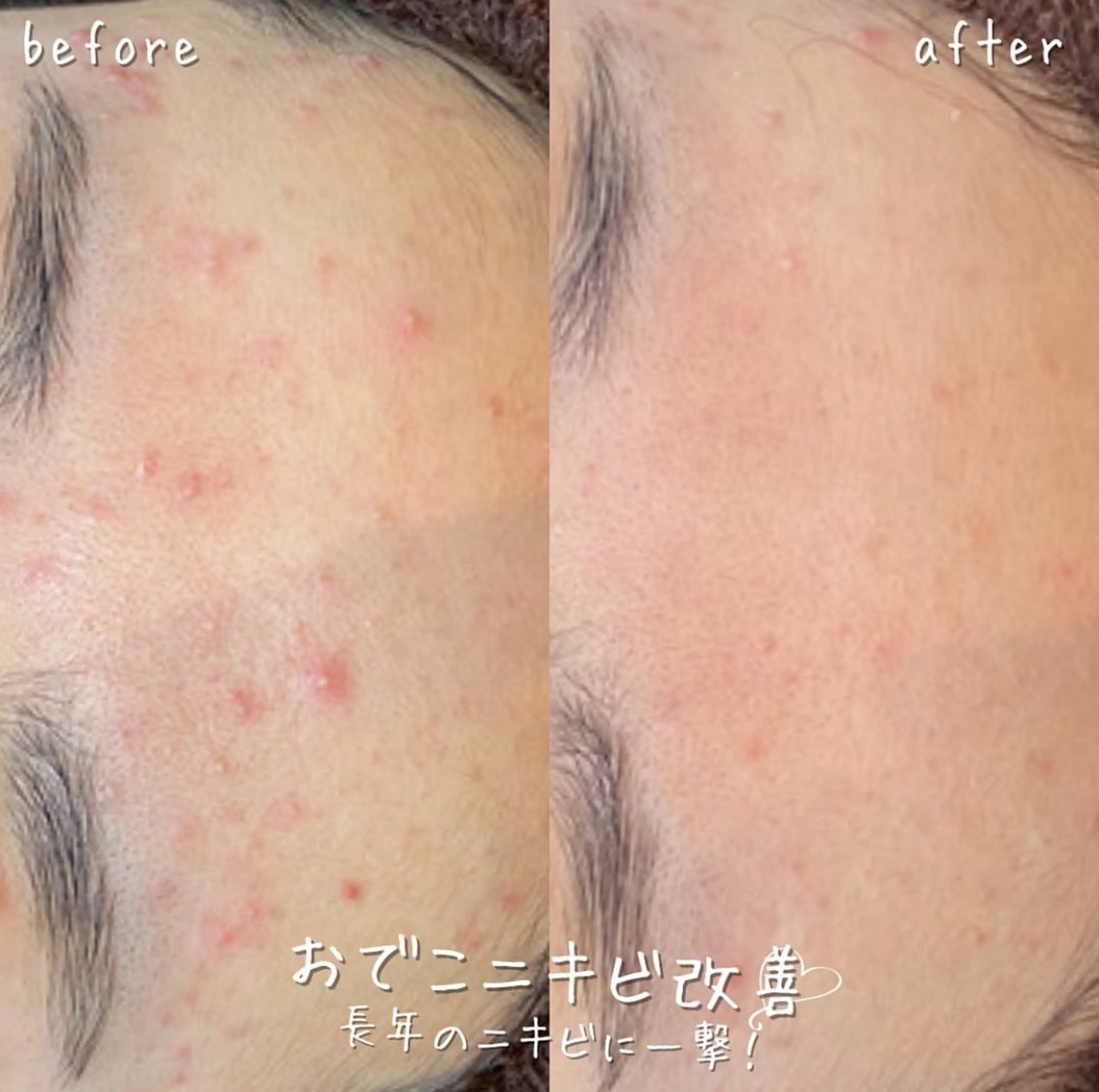 NA skin たまプラーザ　川島のエステ・リラクイメージ