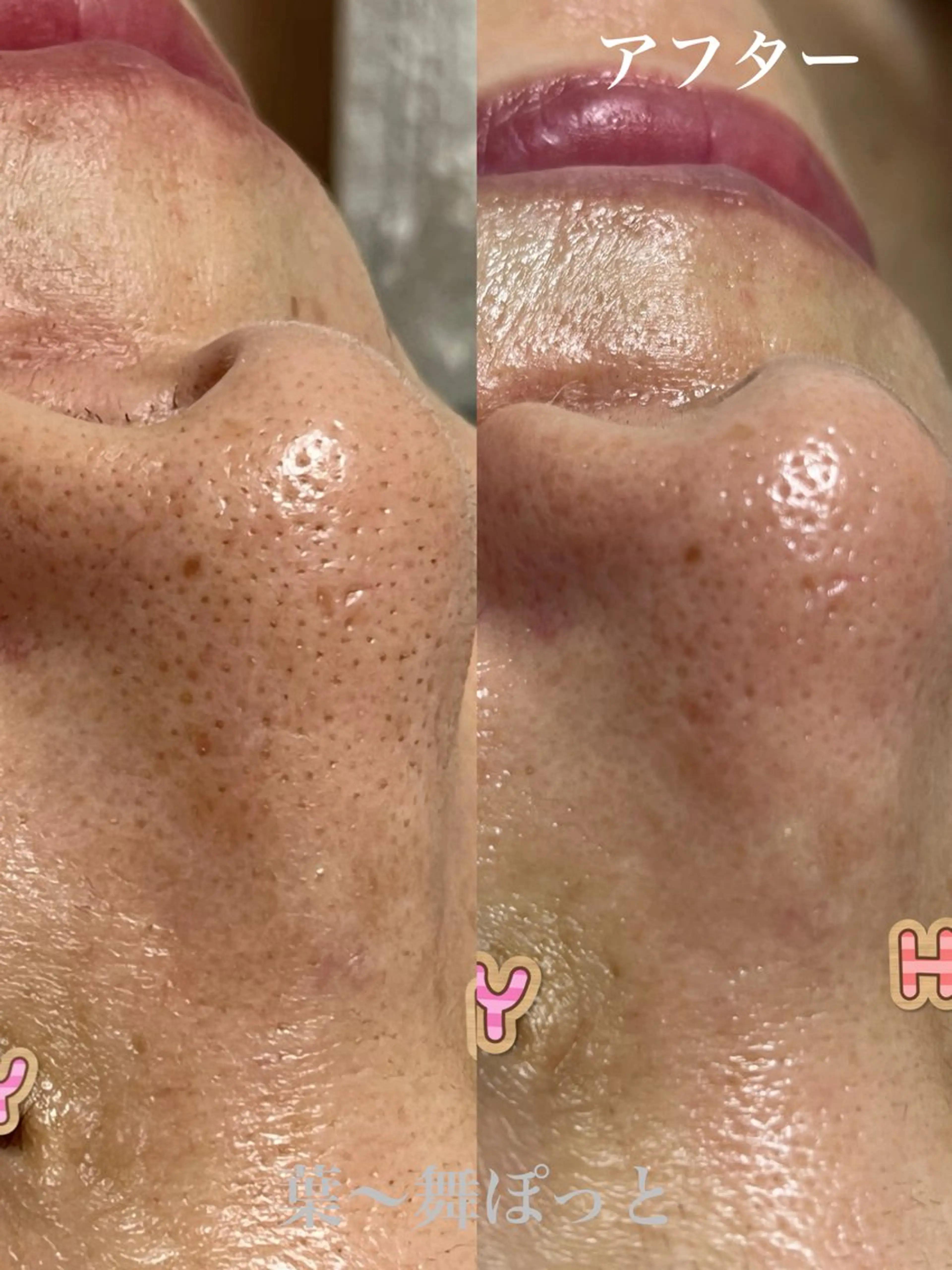 うえつま ふみえのエステ・リラクイメージ