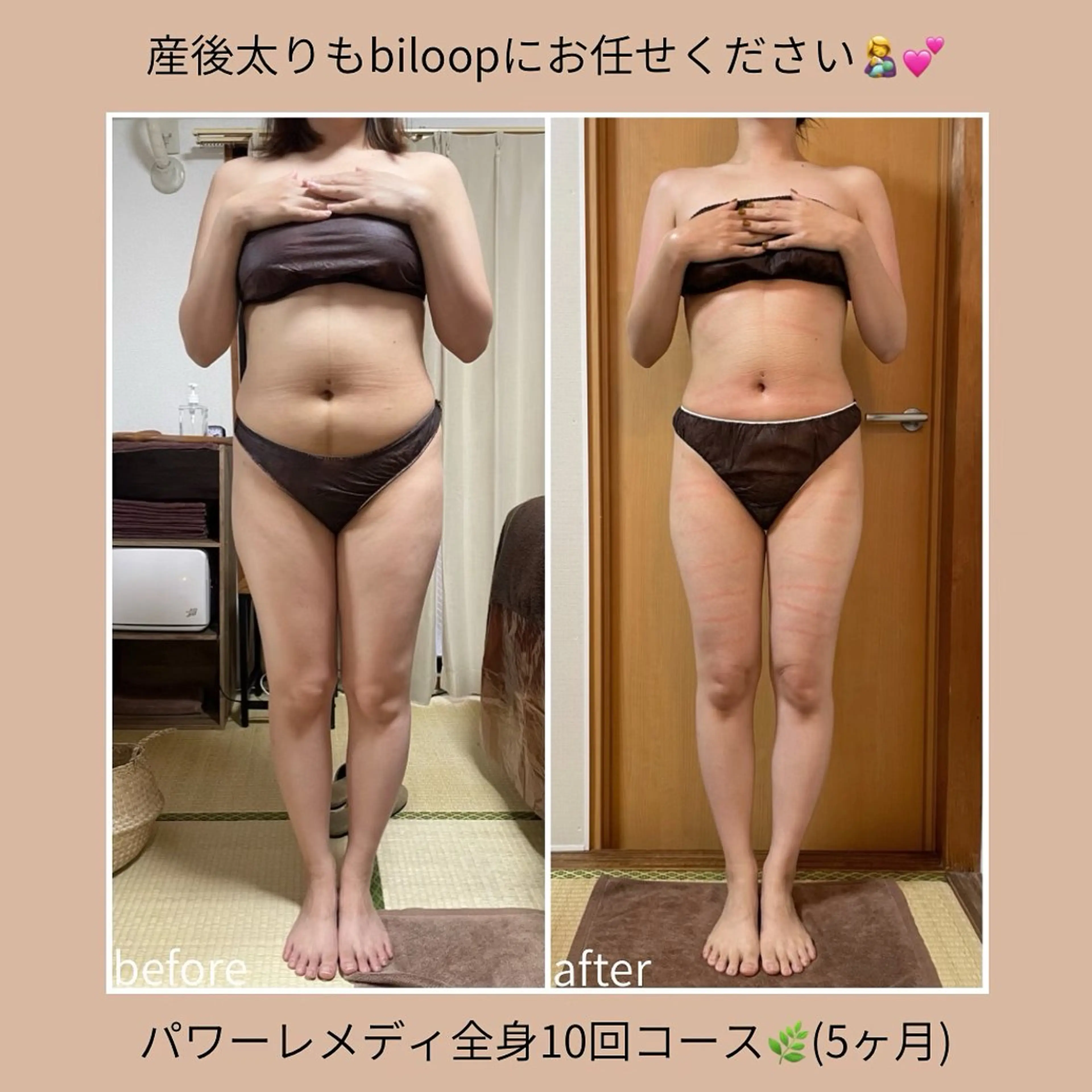 《本気痩せ×疲労改善 》  BILOOPのエステ・リラクイメージ
