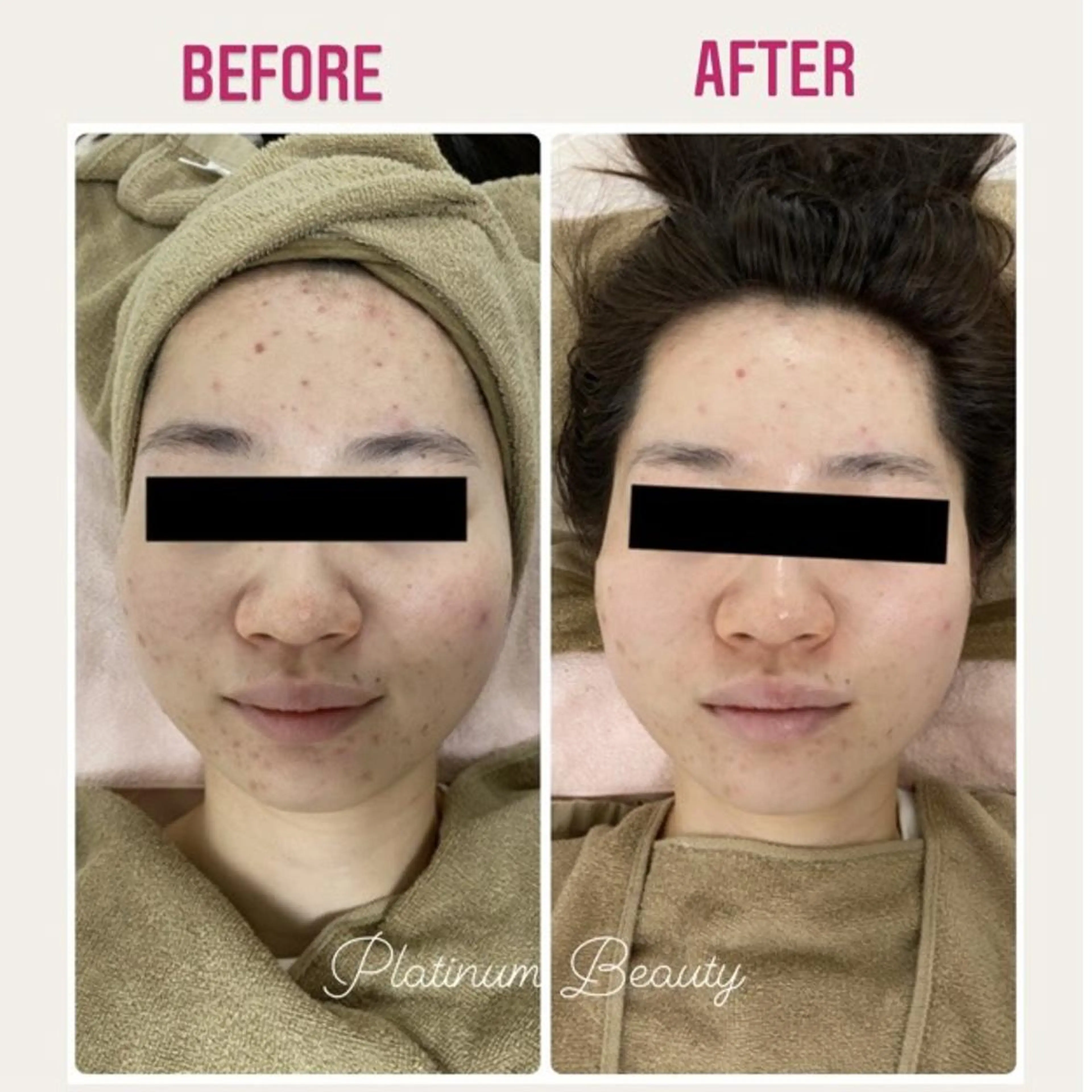 エステ プラティーヌ ボーテのその他イメージ