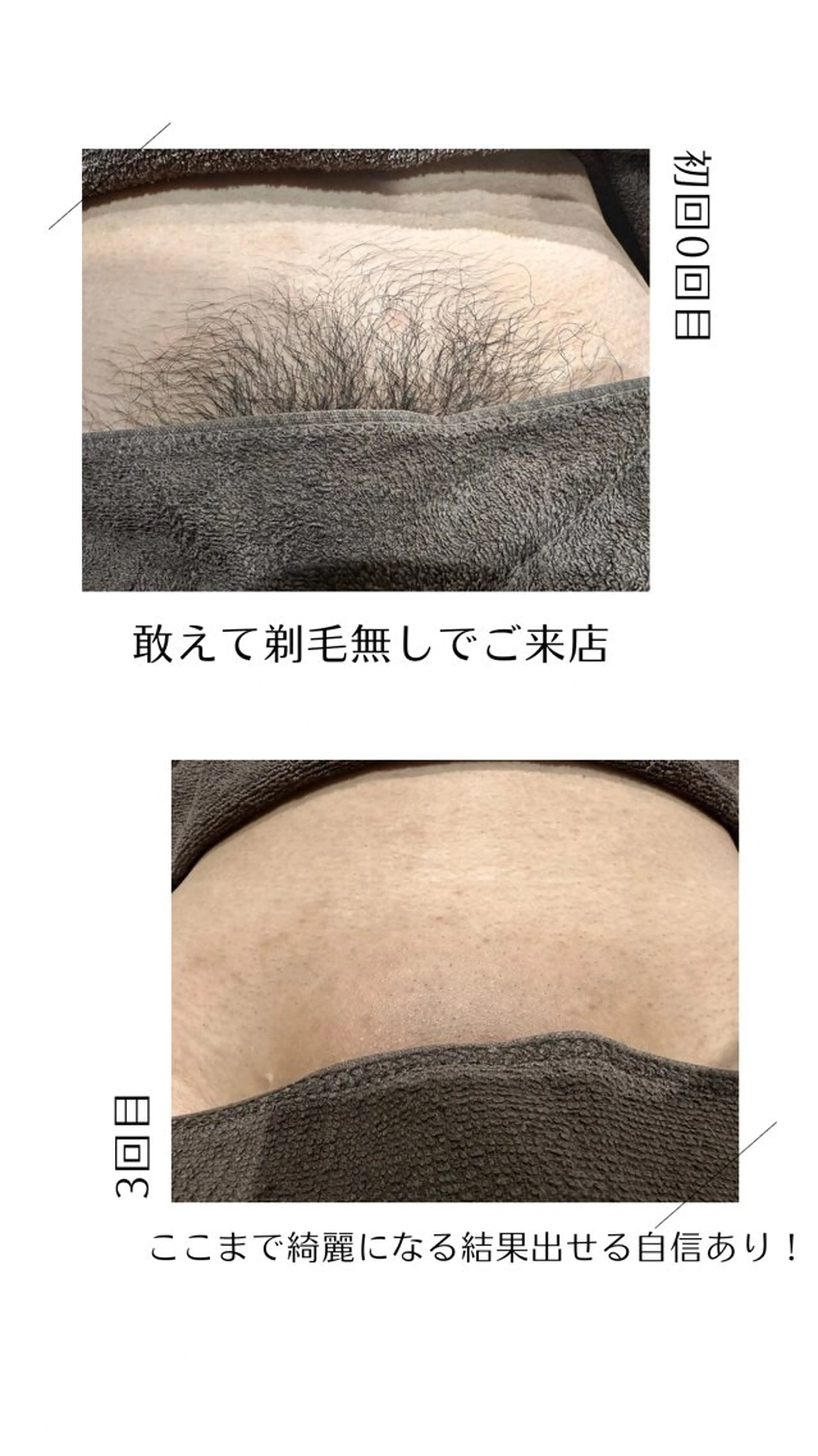 脱毛 VANILLA SKY所属・VANILLA SKYのエステ・リラクイメージ