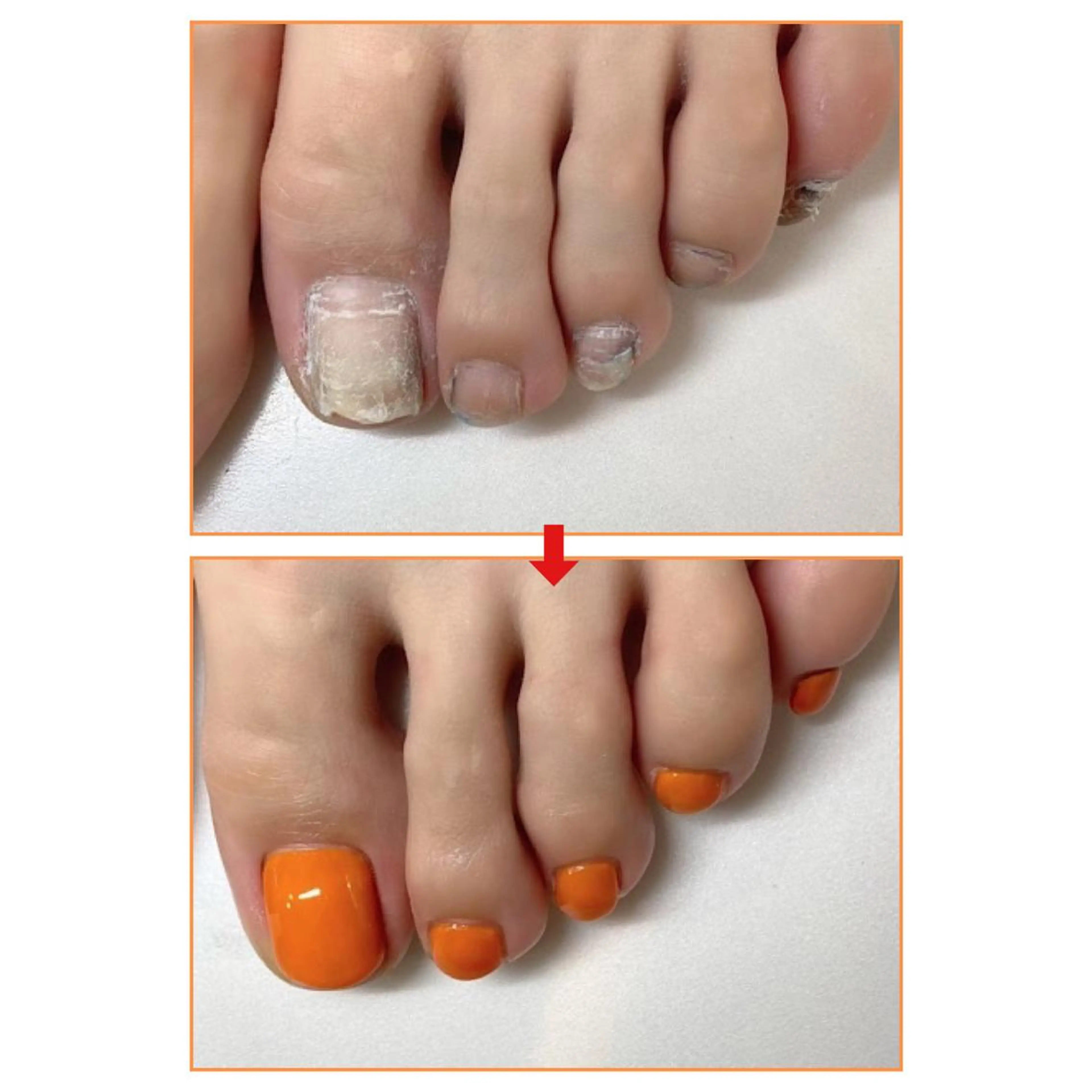 ネイル ネイルサロン アリュームのネイルデザイン