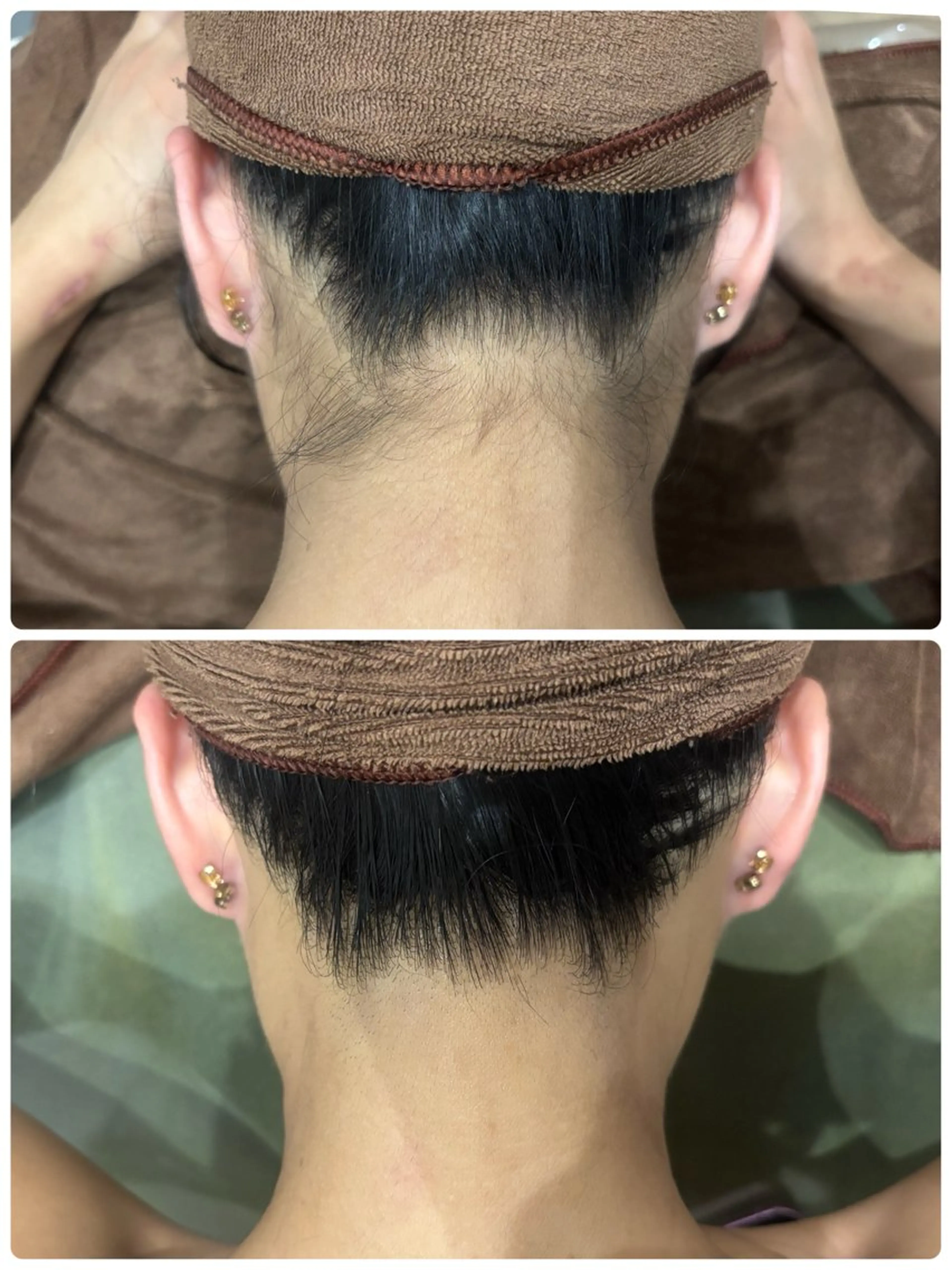 ✨️U24学割キャンペーン✨️うなじ脱毛体験❣️¥3300→¥1650の写真