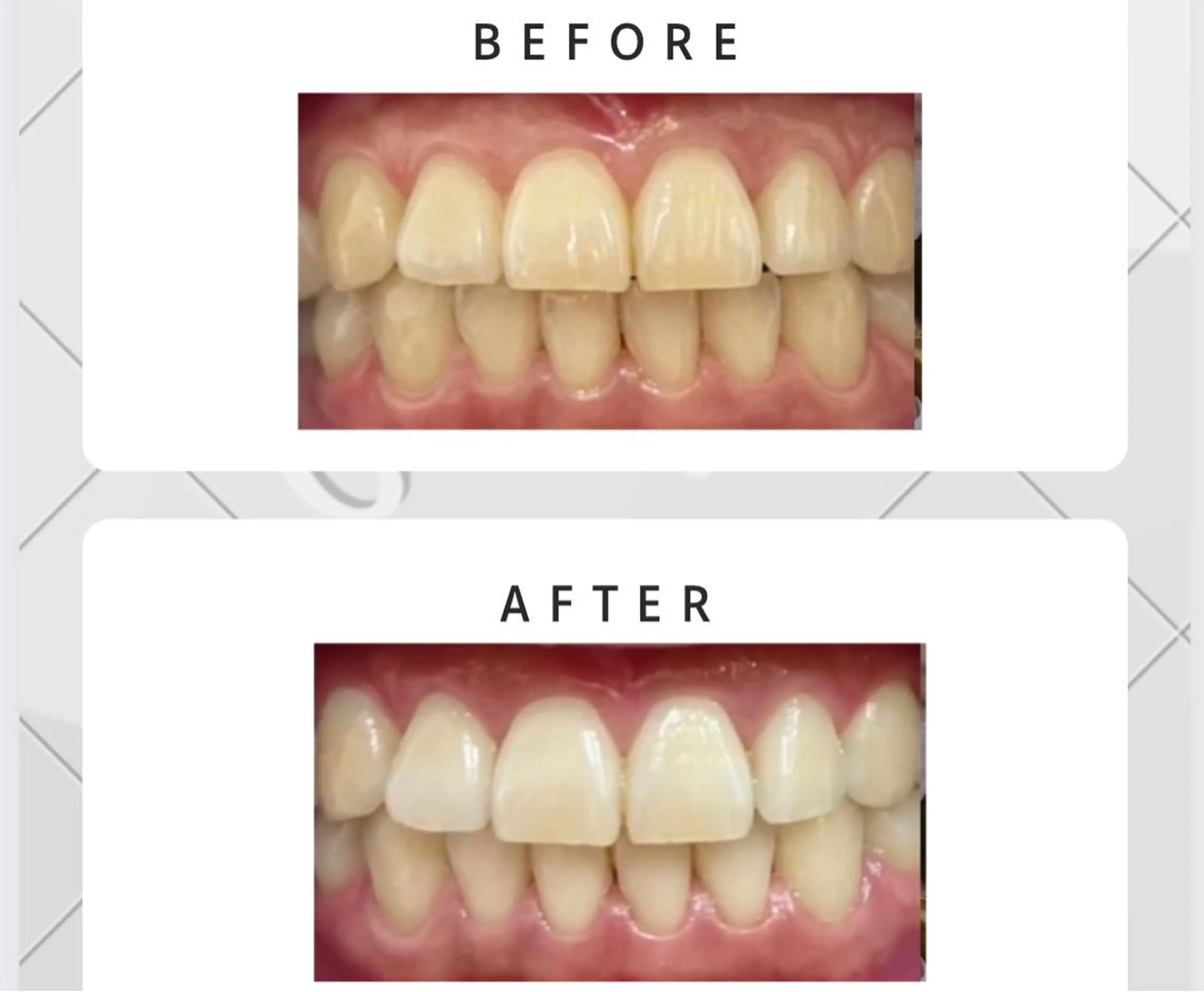 eyeriche .のマツエク・マツパデザイン