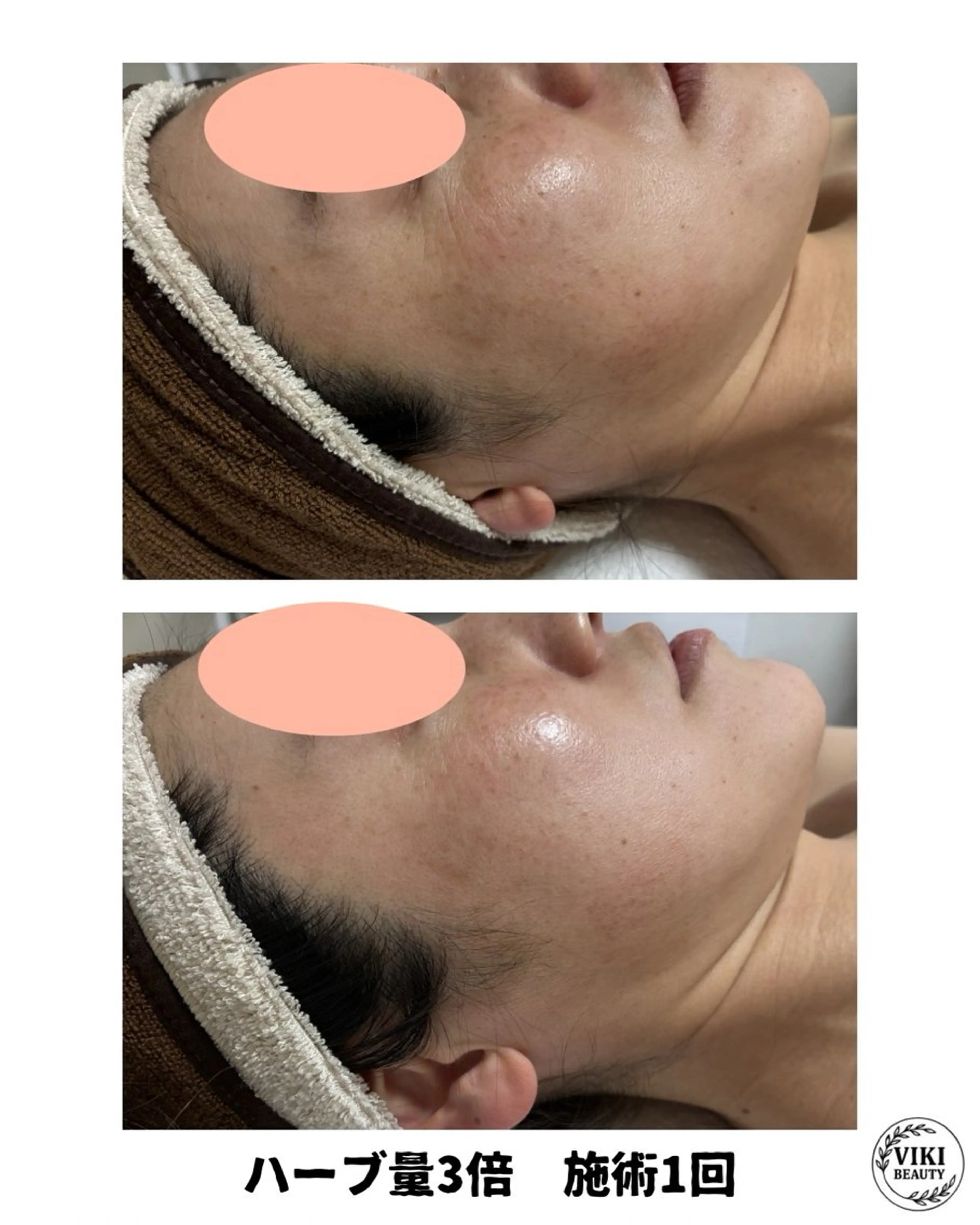 VIKI BEAUTYのエステ・リラクイメージ