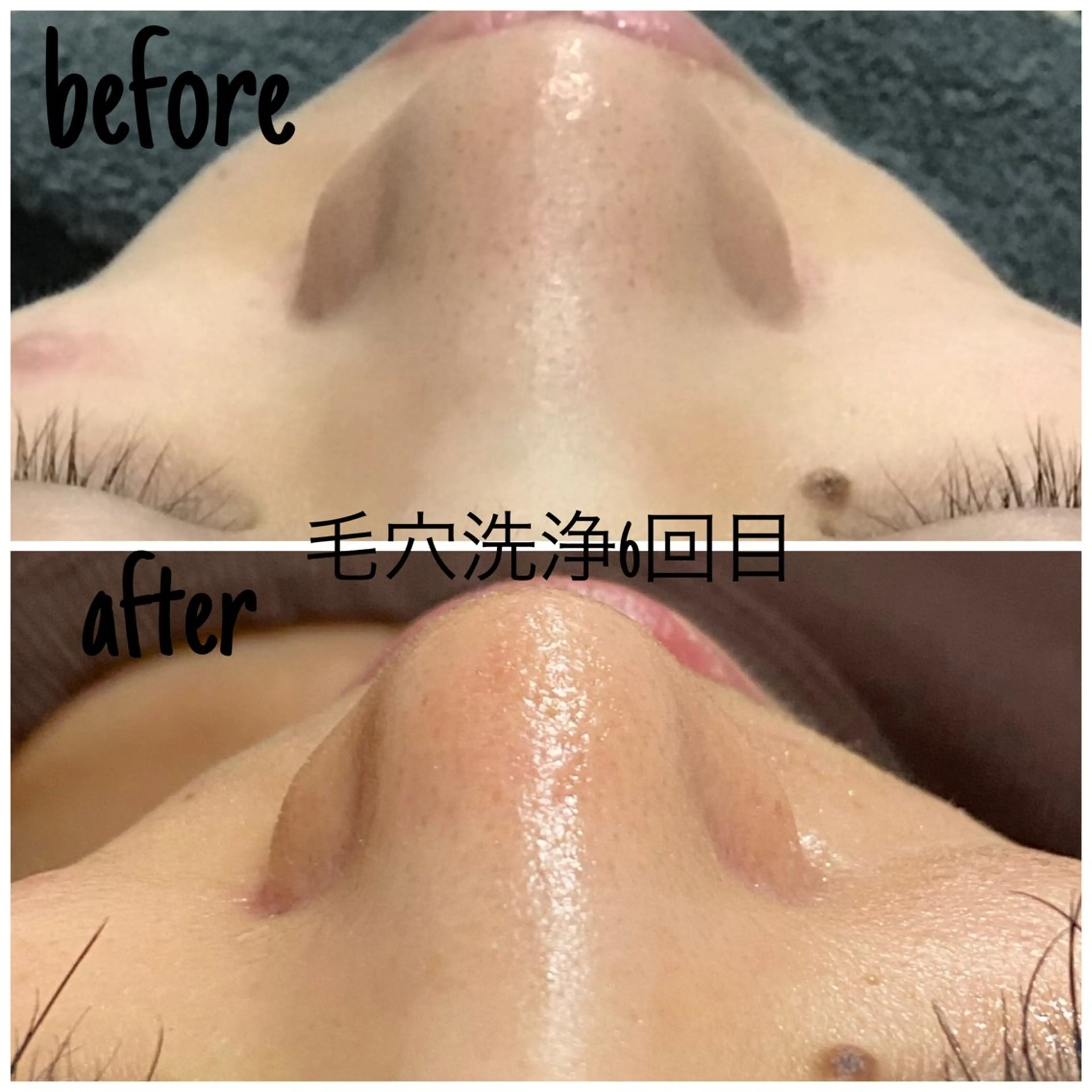 エステ 毛穴洗浄・痩身・脱毛 /アルカンジュのエステ・リラクイメージ