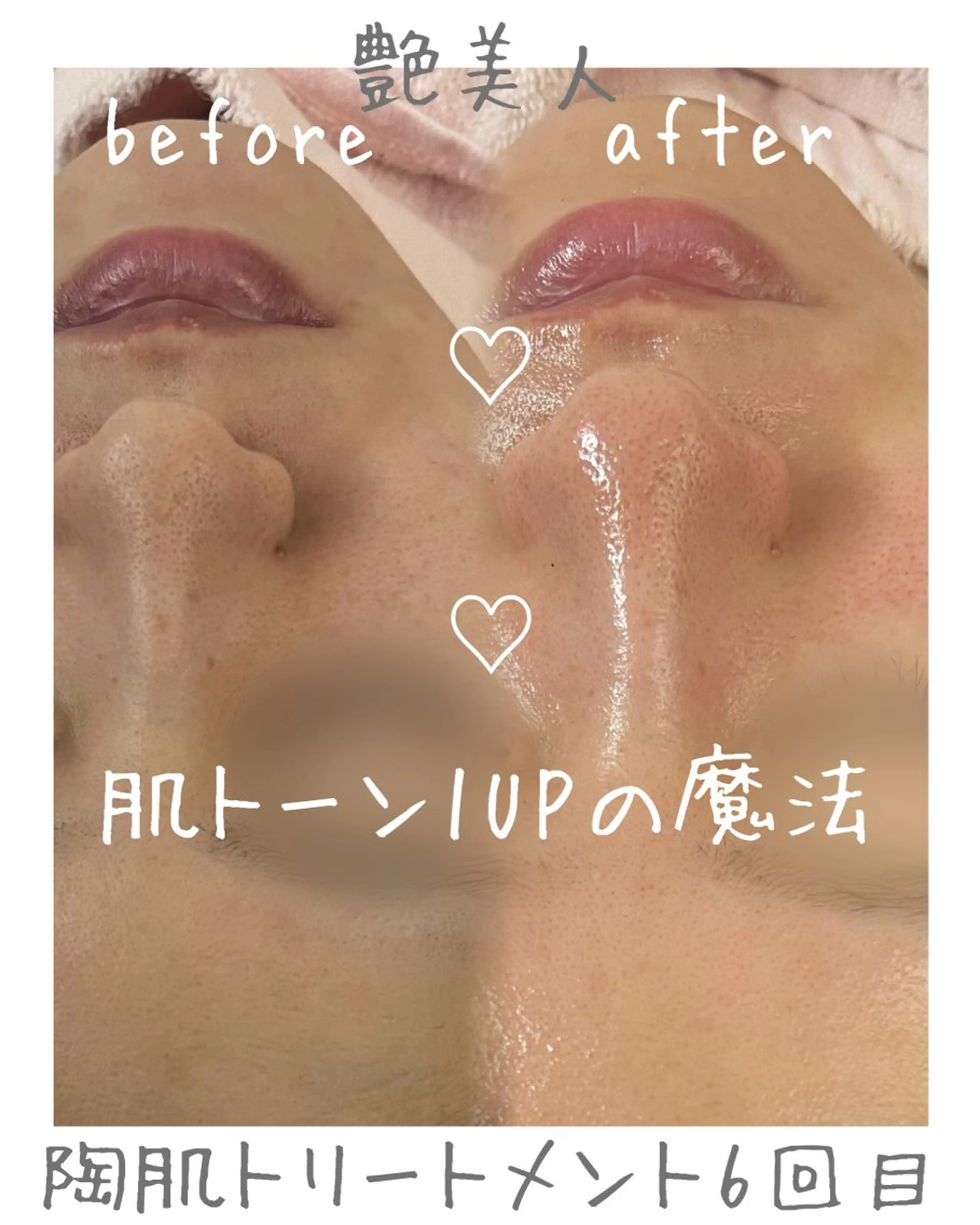 エステ miki 東根の肌質改善サロンのエステ・リラクイメージ