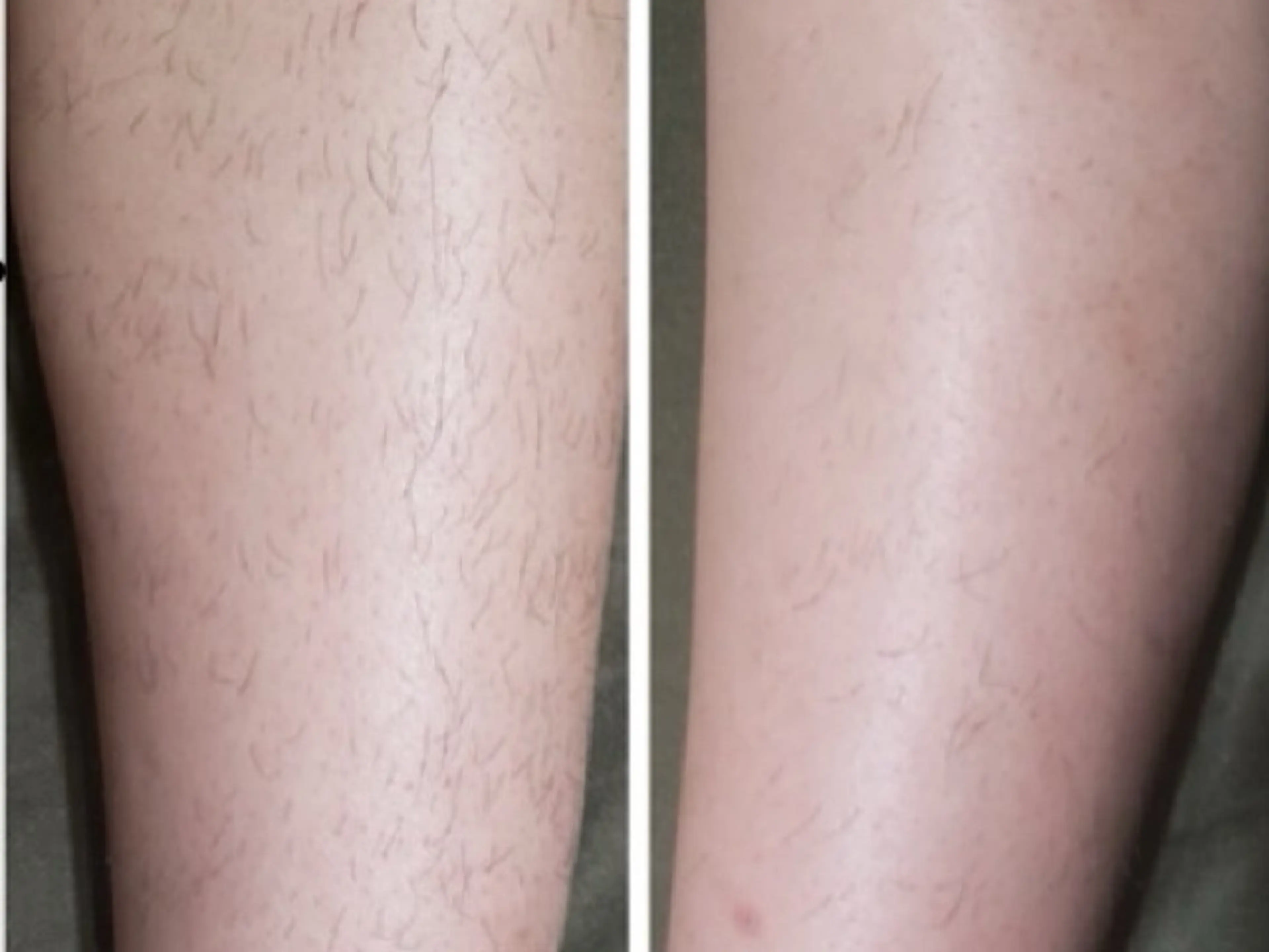 脱毛専門減毛サロン LULU.tokyoのエステ・リラクイメージ