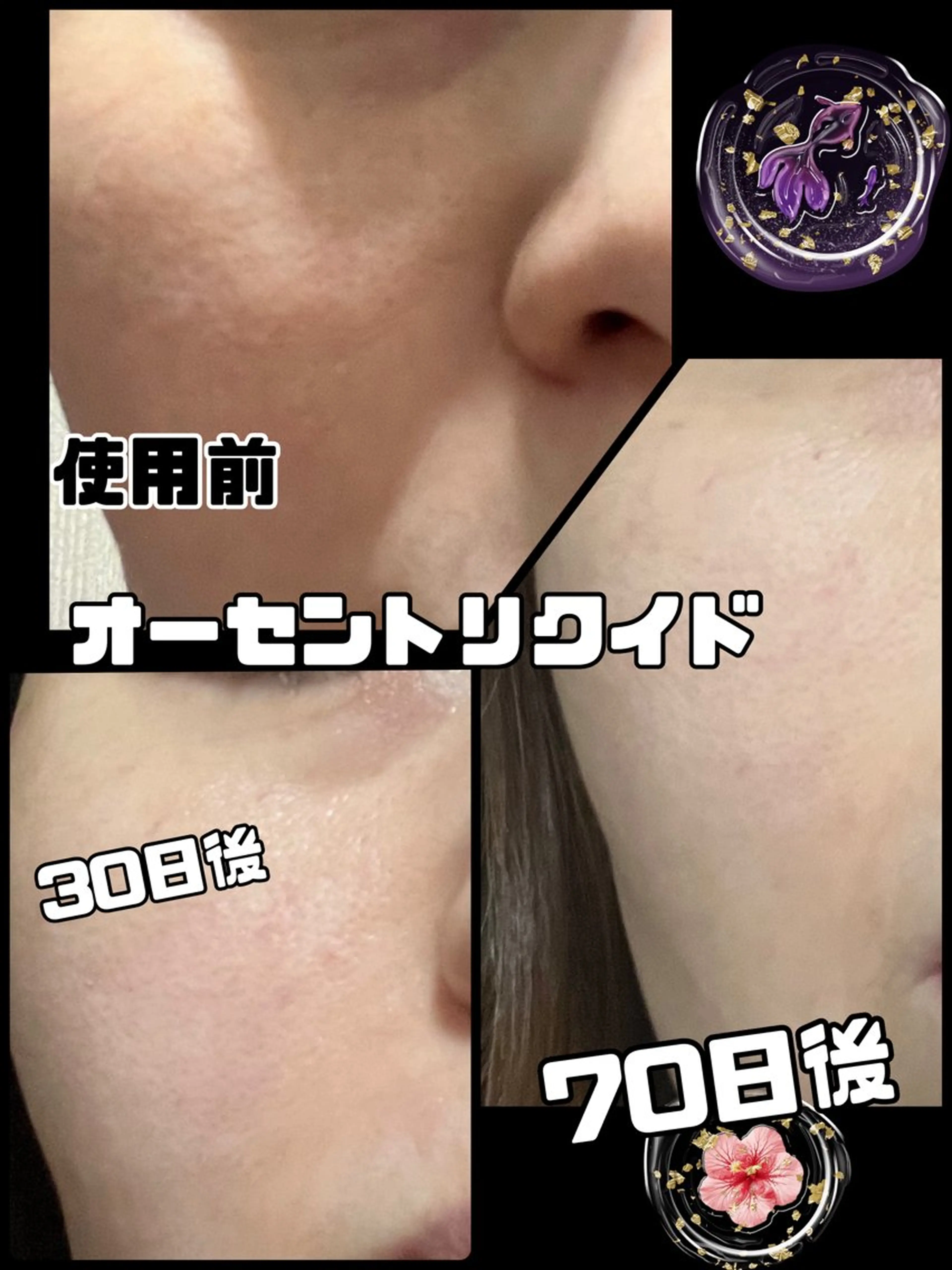 【安心ハンドテク】 メナード富田丘のエステ・リラクイメージ