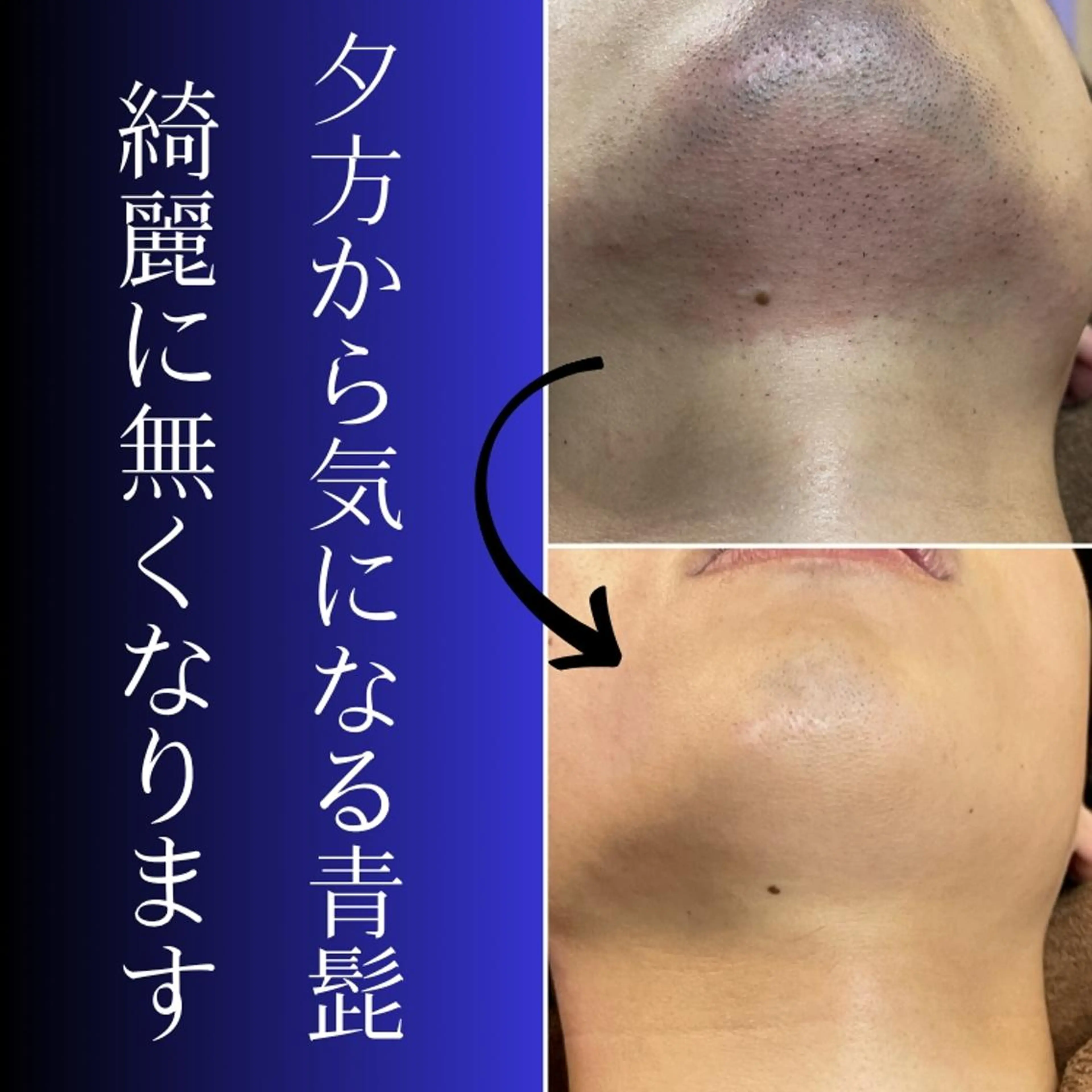 メンズ 脱毛 Sakamoto Yukiの眉毛・アイブロウイメージ