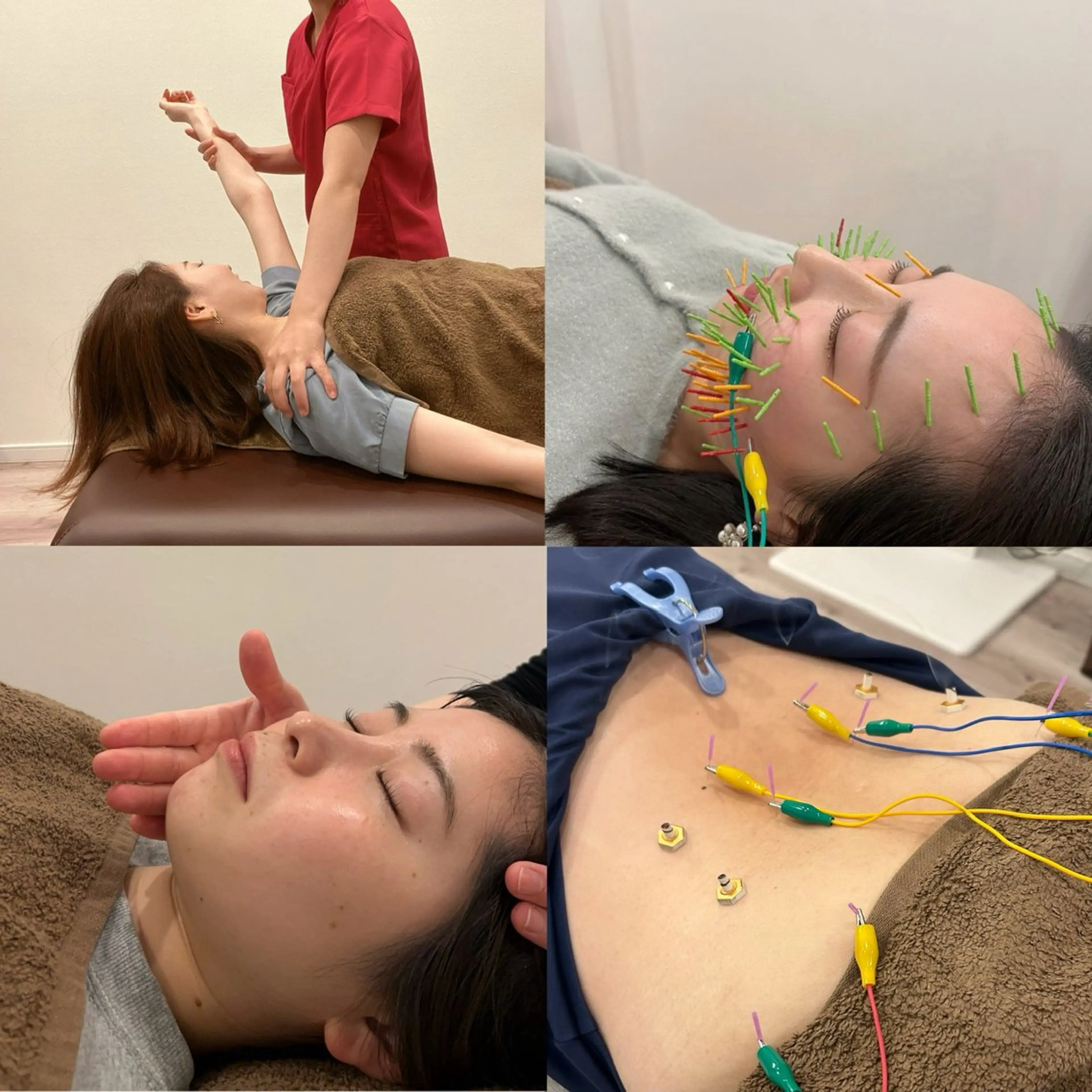 エステ リラク 美容鍼灸Solana所属・肌質改善×美容鍼 ゆいのエステ・リラクイメージ