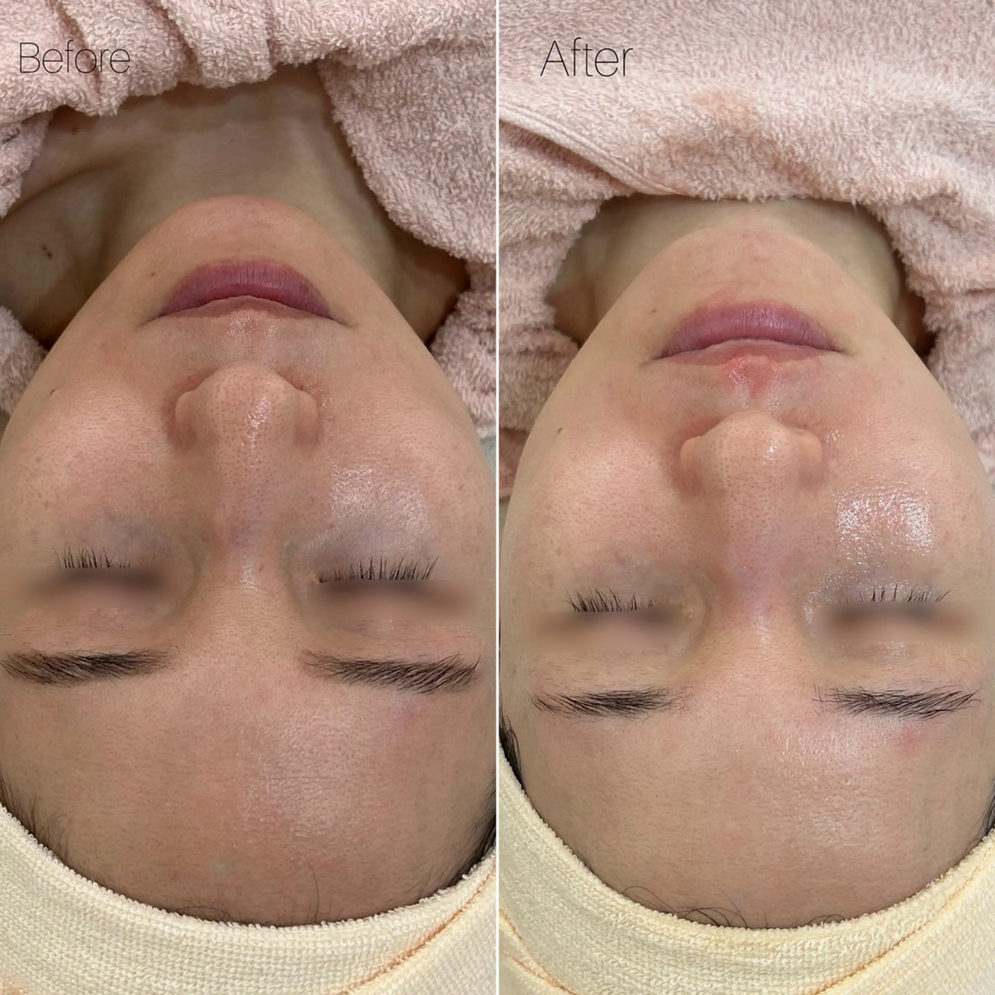 etre - 韓国肌管理 -のエステ・リラクイメージ