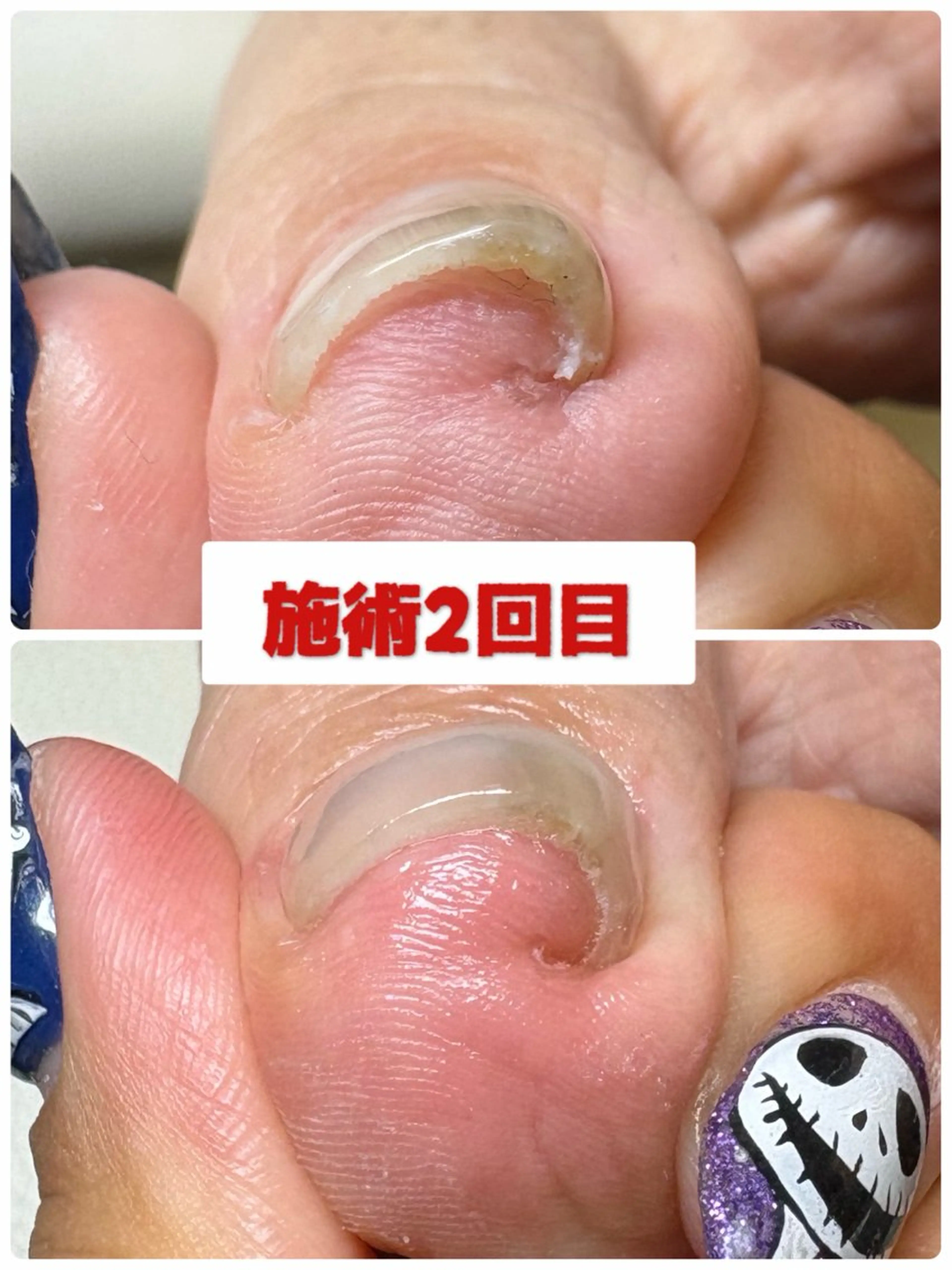 ネイル フットネイル -TOIRO- Eriのネイルデザイン