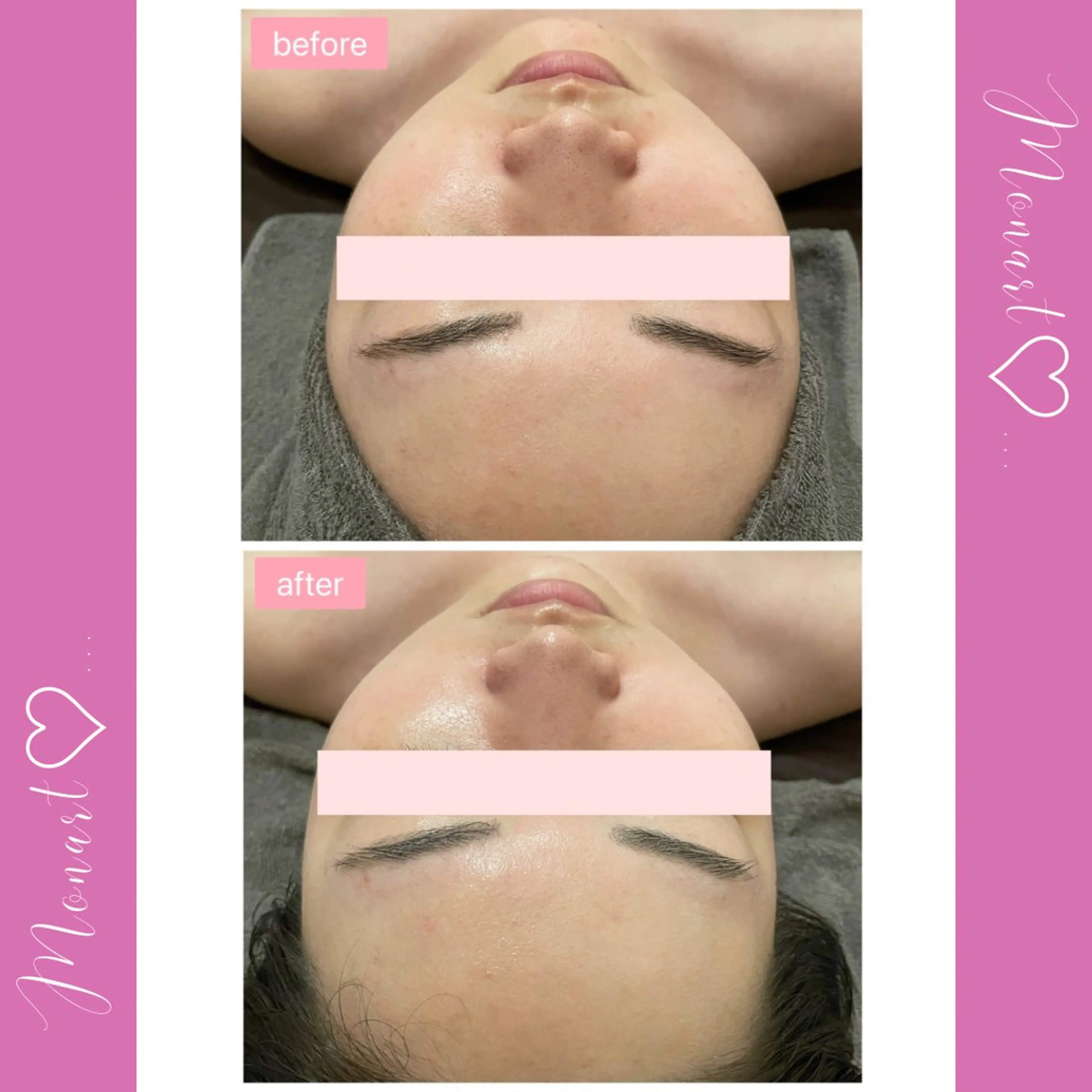 Monart -deux-のエステ・リラクイメージ