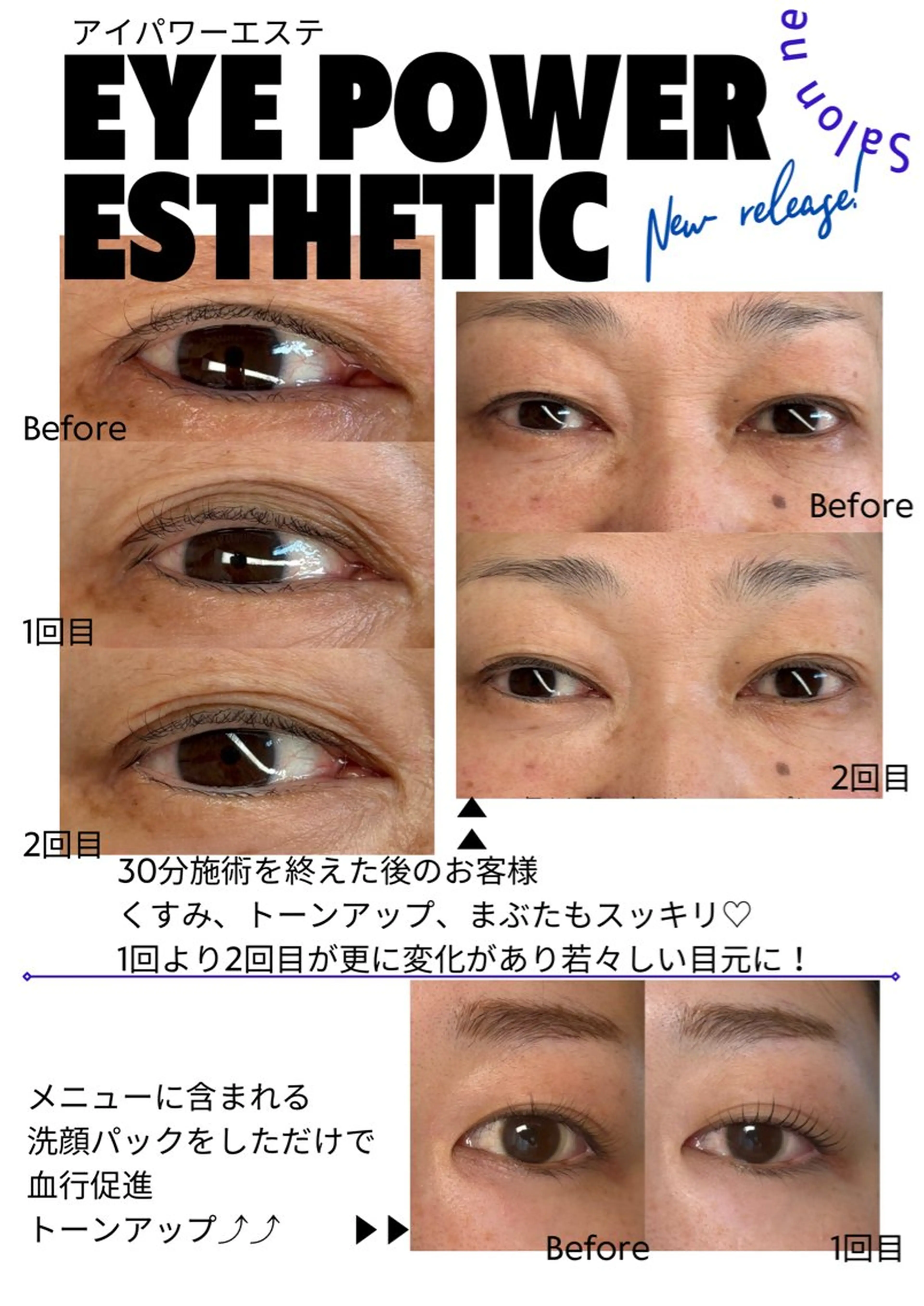 【いつまでも綺麗なまつ毛】アイパワーエステ＋まつ毛パーマ通常17160円▶︎14500円の写真