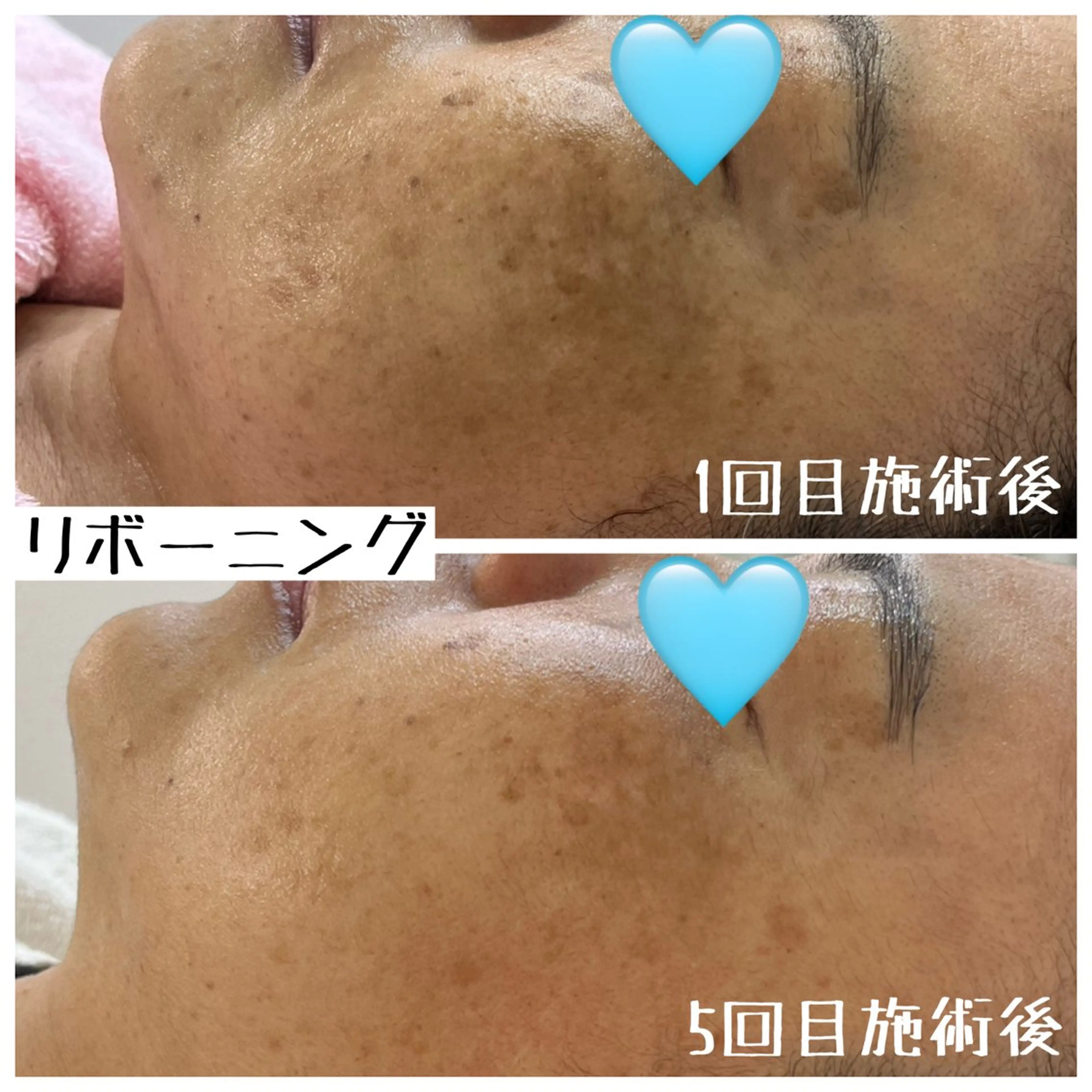 【脱毛と肌育のお店】 sharan✨✨のエステ・リラクイメージ