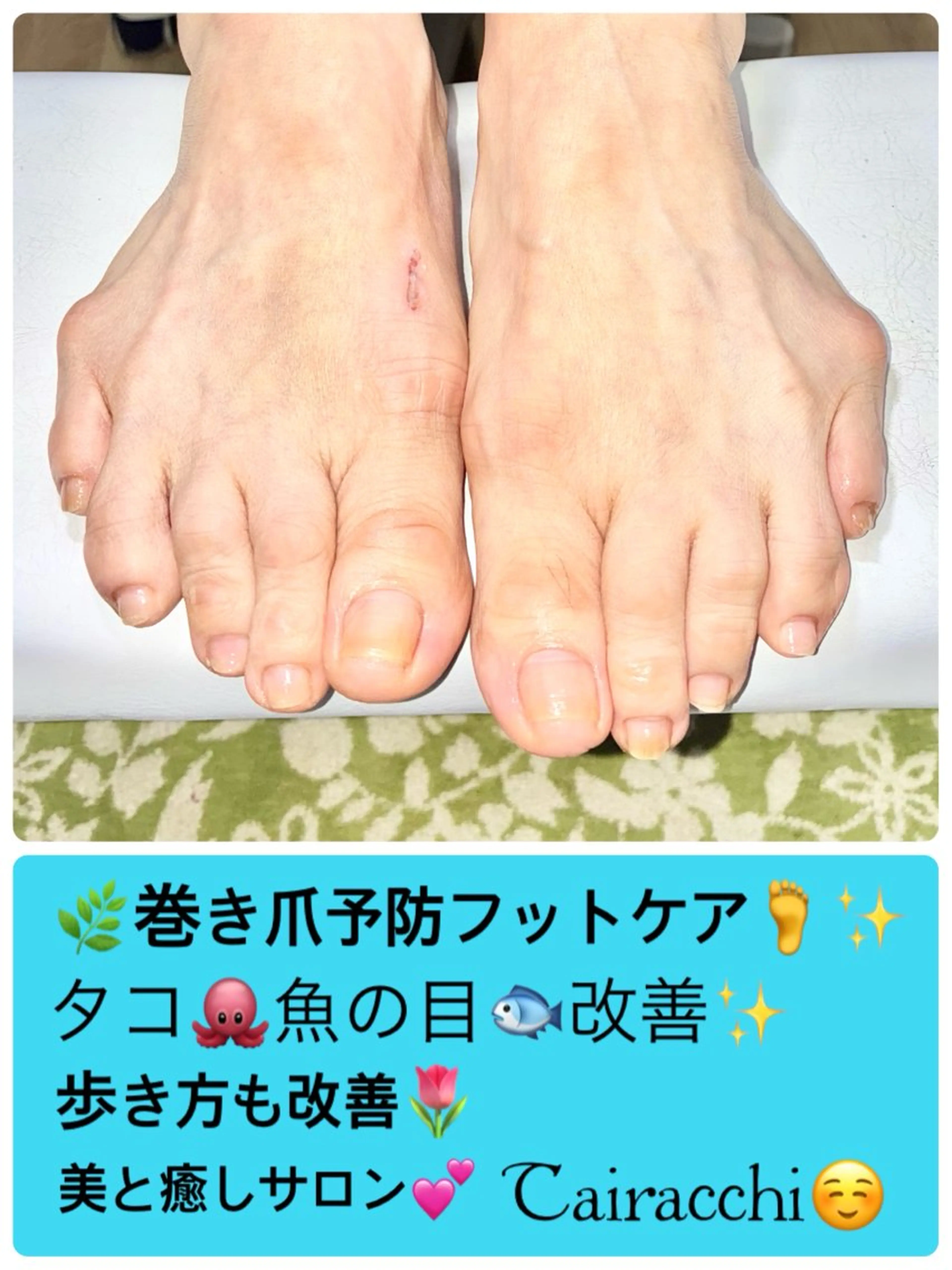 ネイル フットネイル Tairacchi タイラッチのネイルデザイン
